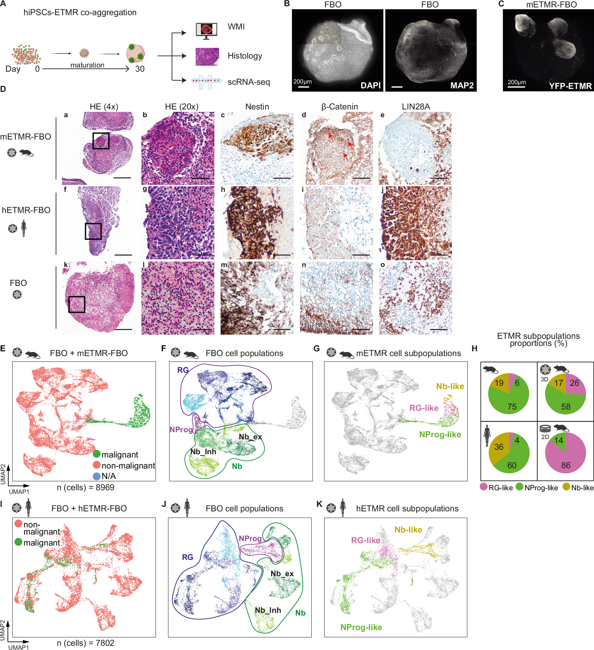 Fig. 4: ETMR cellular heterogeneity was recapitulated in ETMR-forebrain organoids.