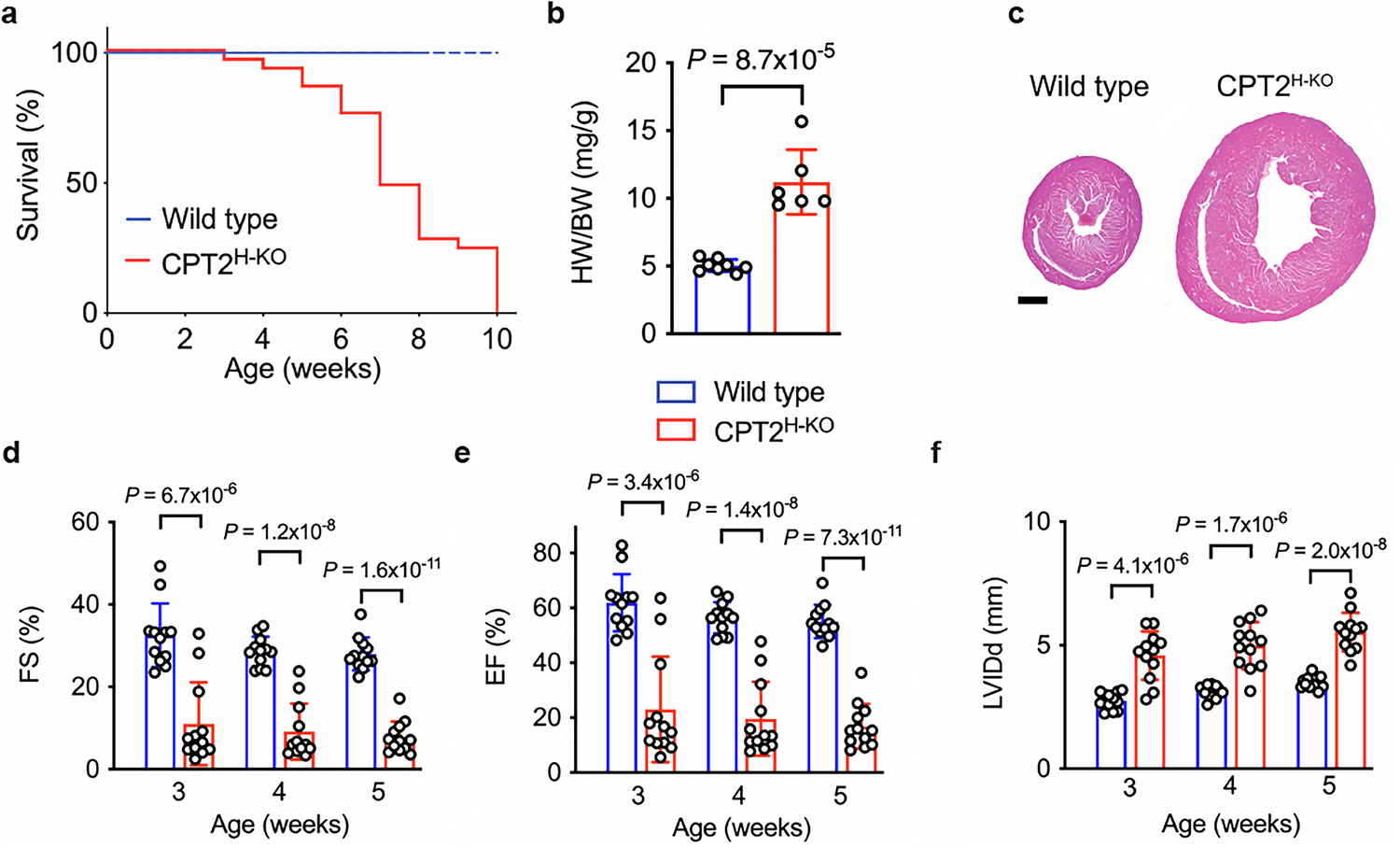 Fig. 2: Cardiac phenotypes of CPT2H-KO mice.