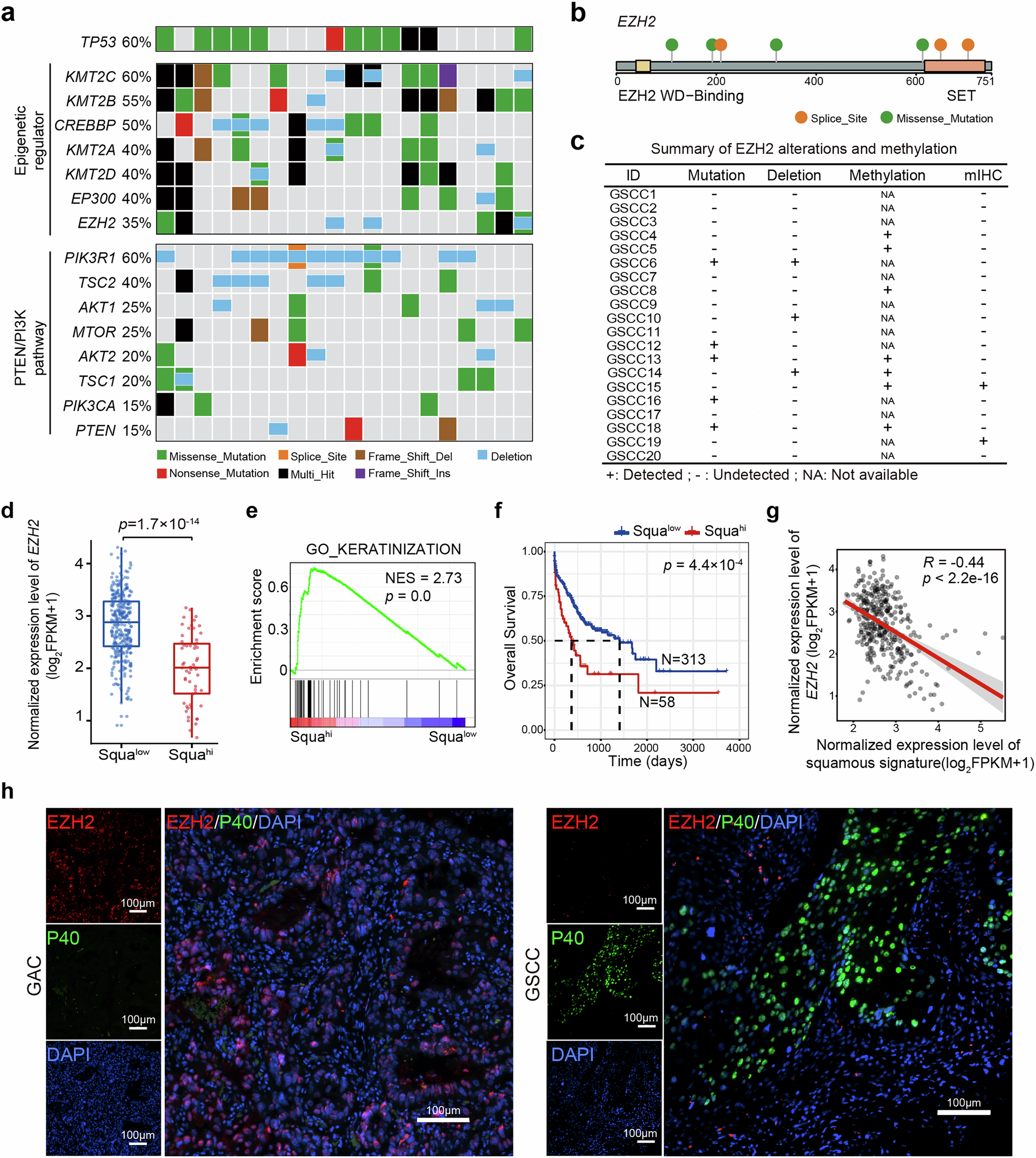 Fig. 1: EZH2 deficiency is associated with GSCC.