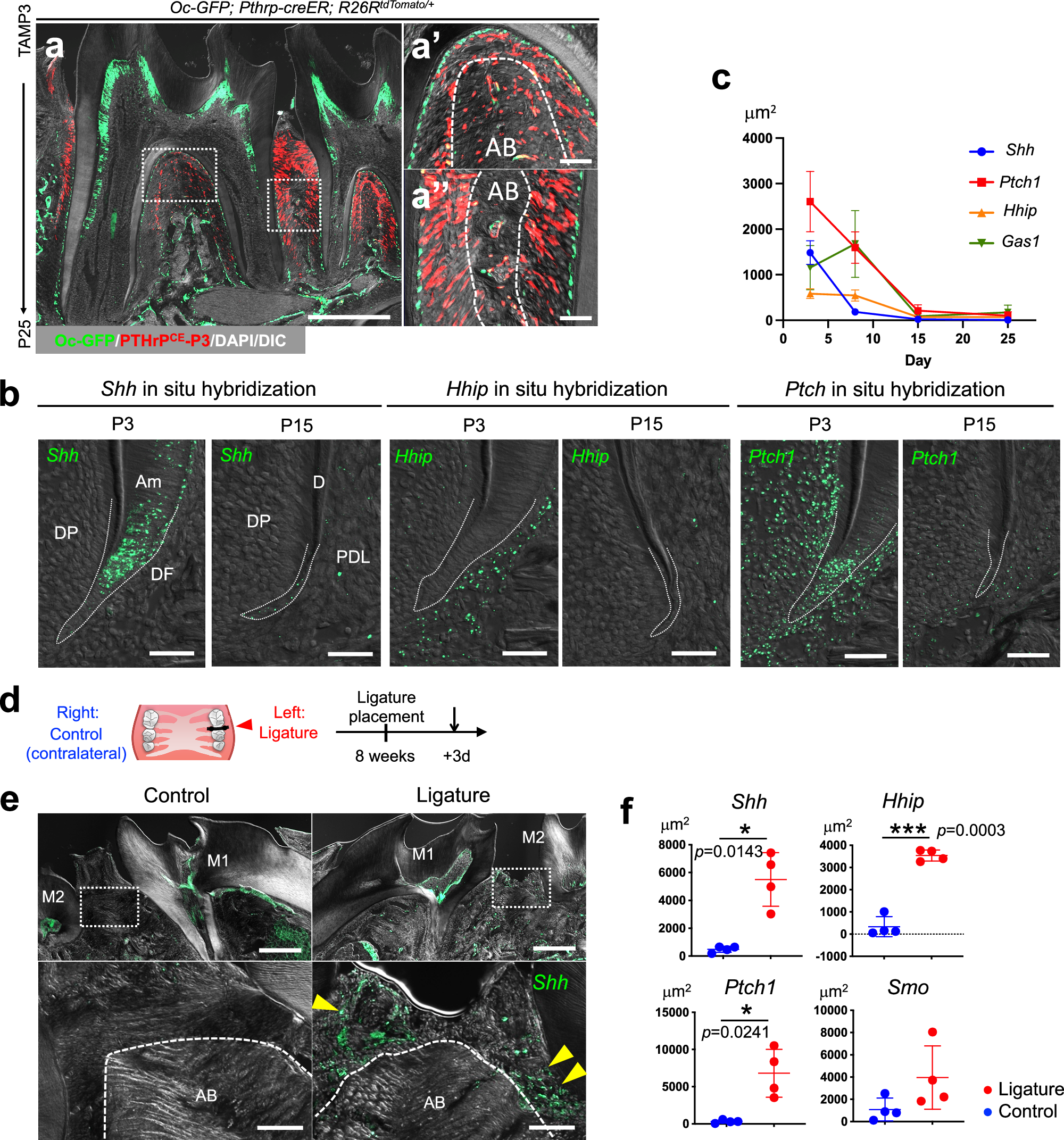 A Hedgehog–Foxf axis coordinates dental follicle-derived alveolar bone  formation | Nature Communications