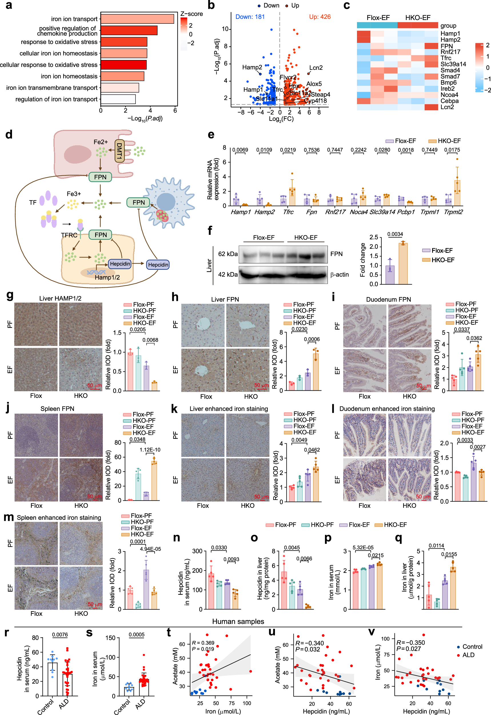 Fig. 3: Hepatocyte-specific ACSS2 depletion aggravates alcohol-induced iron metabolism disorder.
