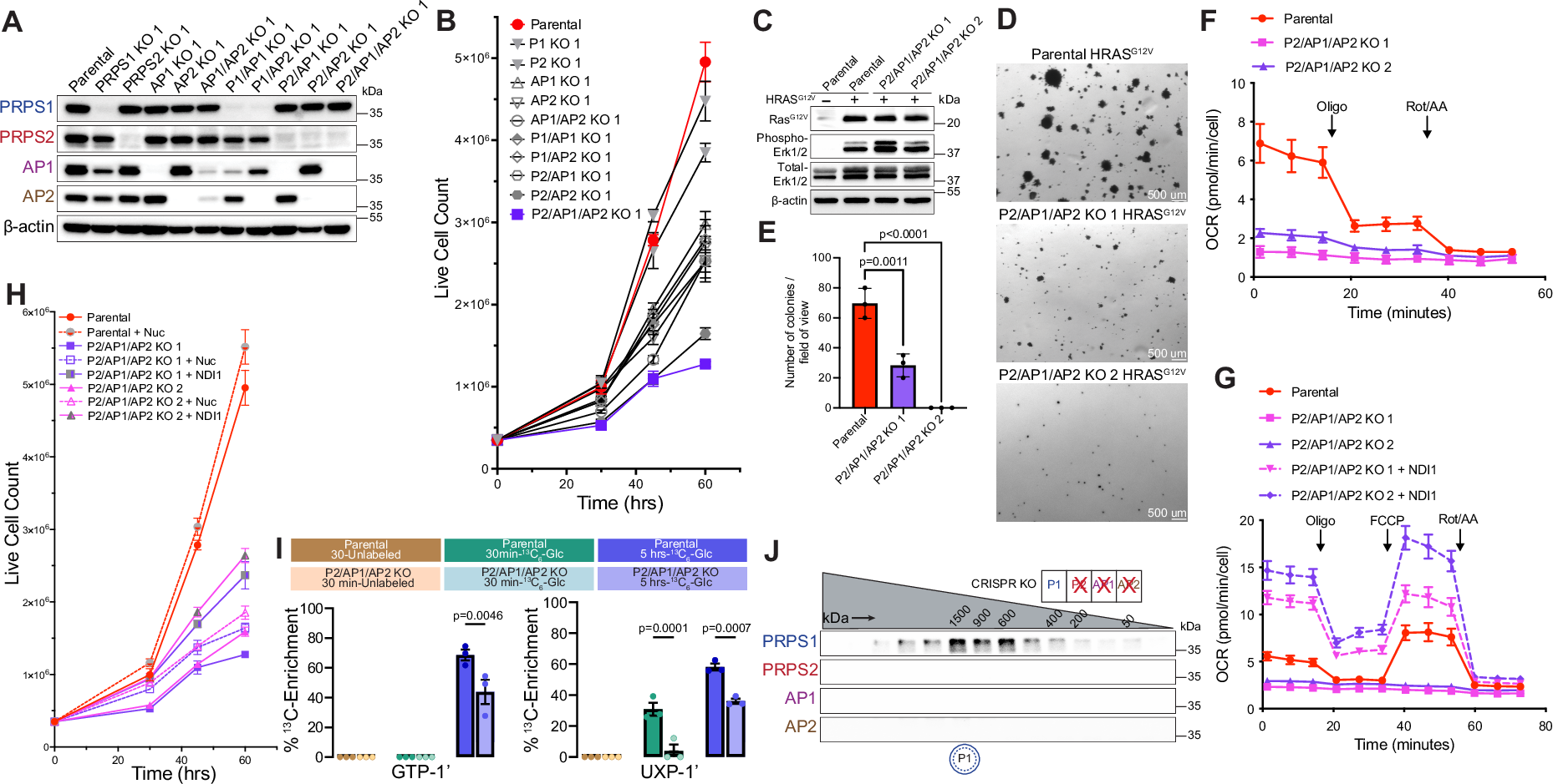 Fig. 4: Cells exclusively expressing PRPS1 display metabolic defects and decreased cellular proliferation.