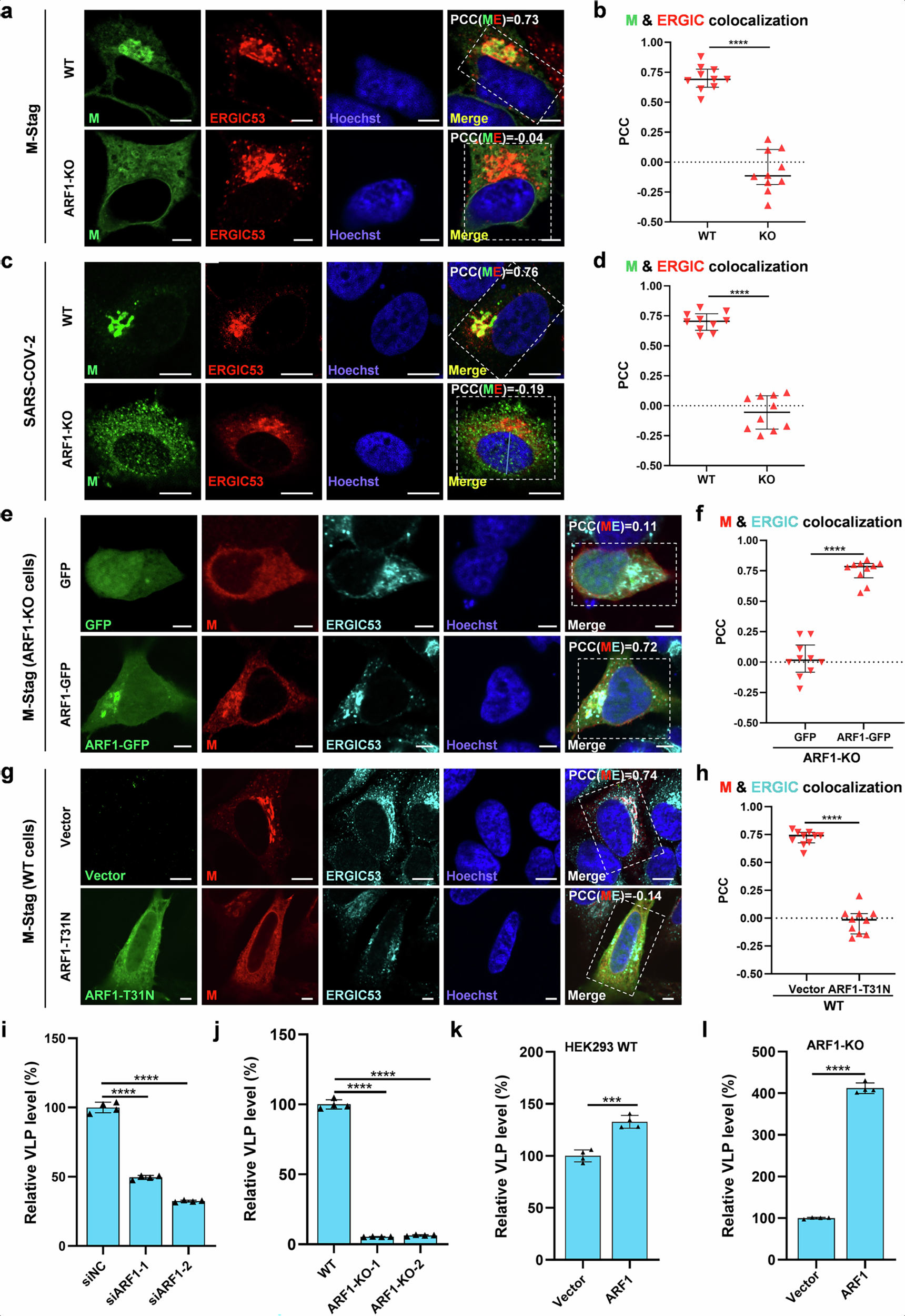 Fig. 4: ARF1 enables M’s accumulation to the EGRIC, boosting M-driven SARS-CoV-2 VLP assembly.