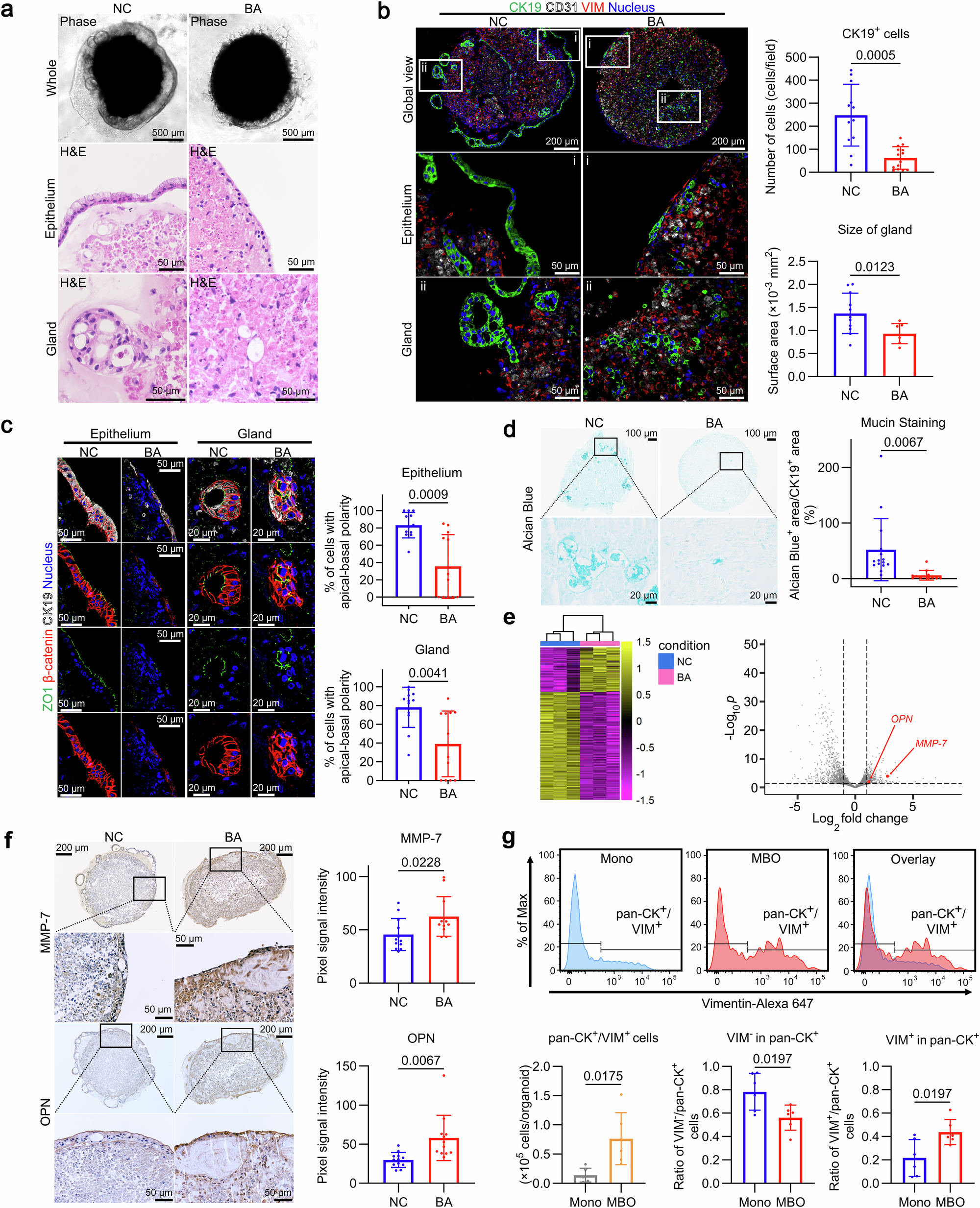 Fig. 2: Modeling human BA using patient-derived MBOs.