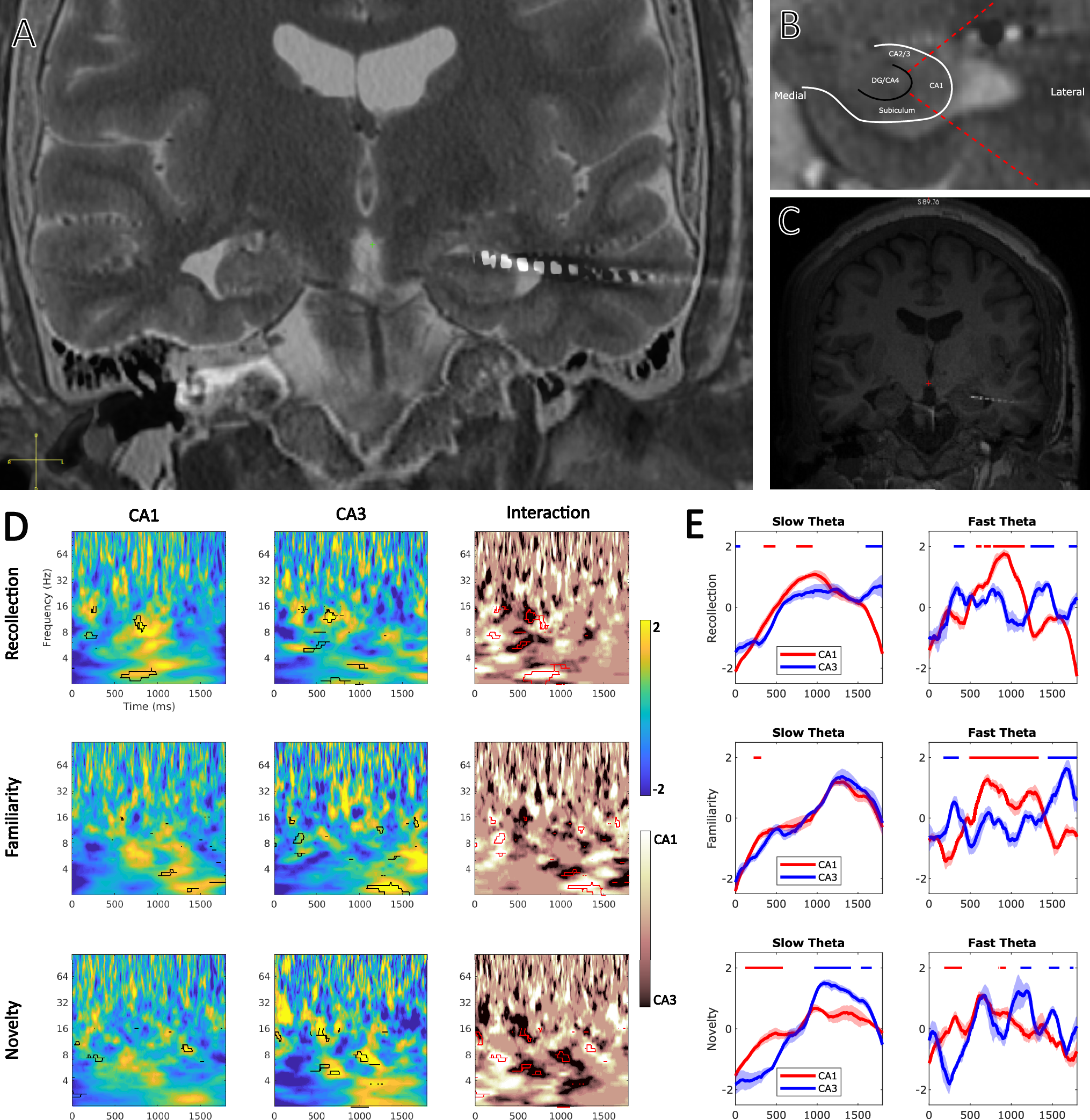 Fig. 7: Analysis of electrodes localized to CA1.