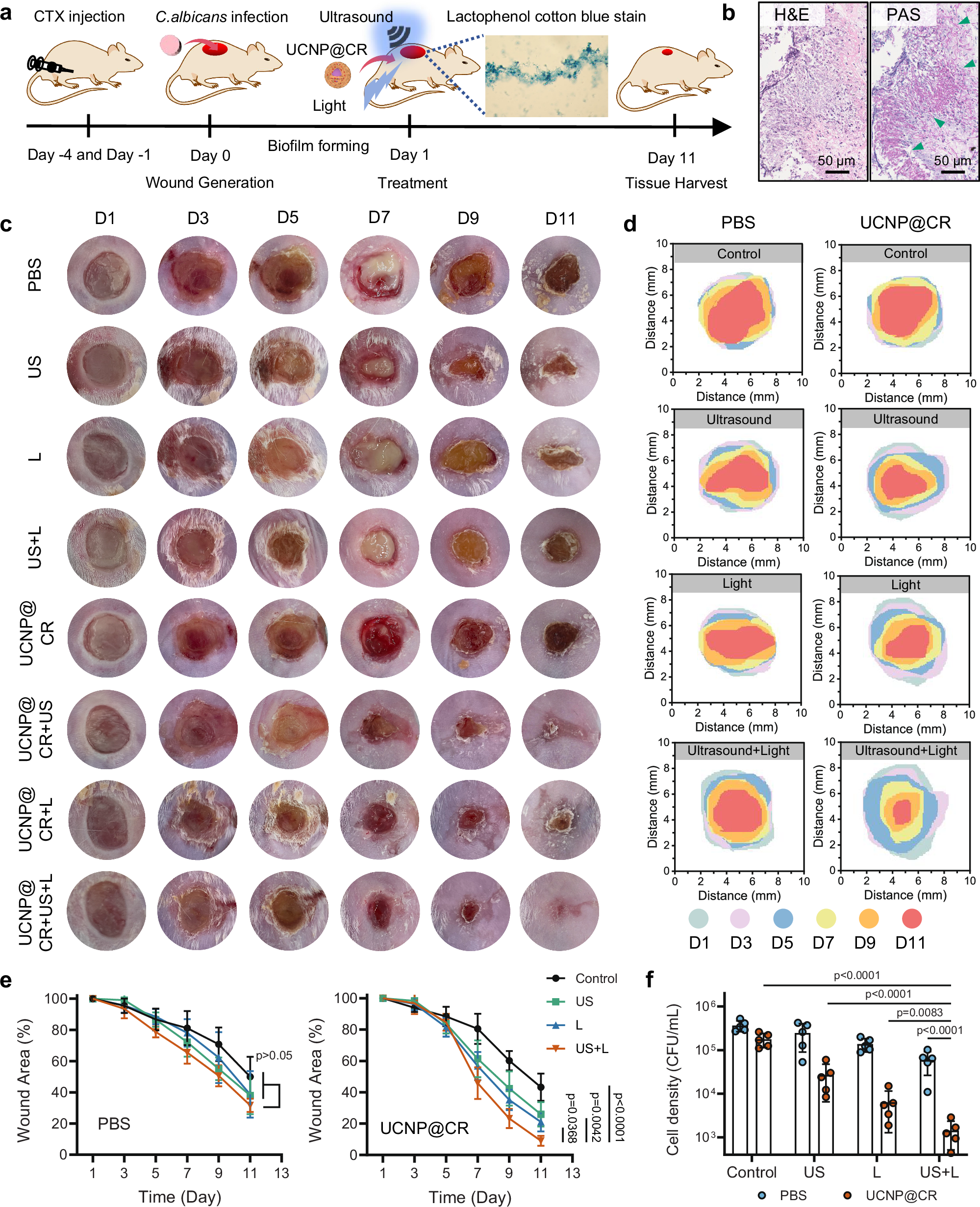 Fig. 7: Effect of UCNP@CR in wound biofilm infection treatment.