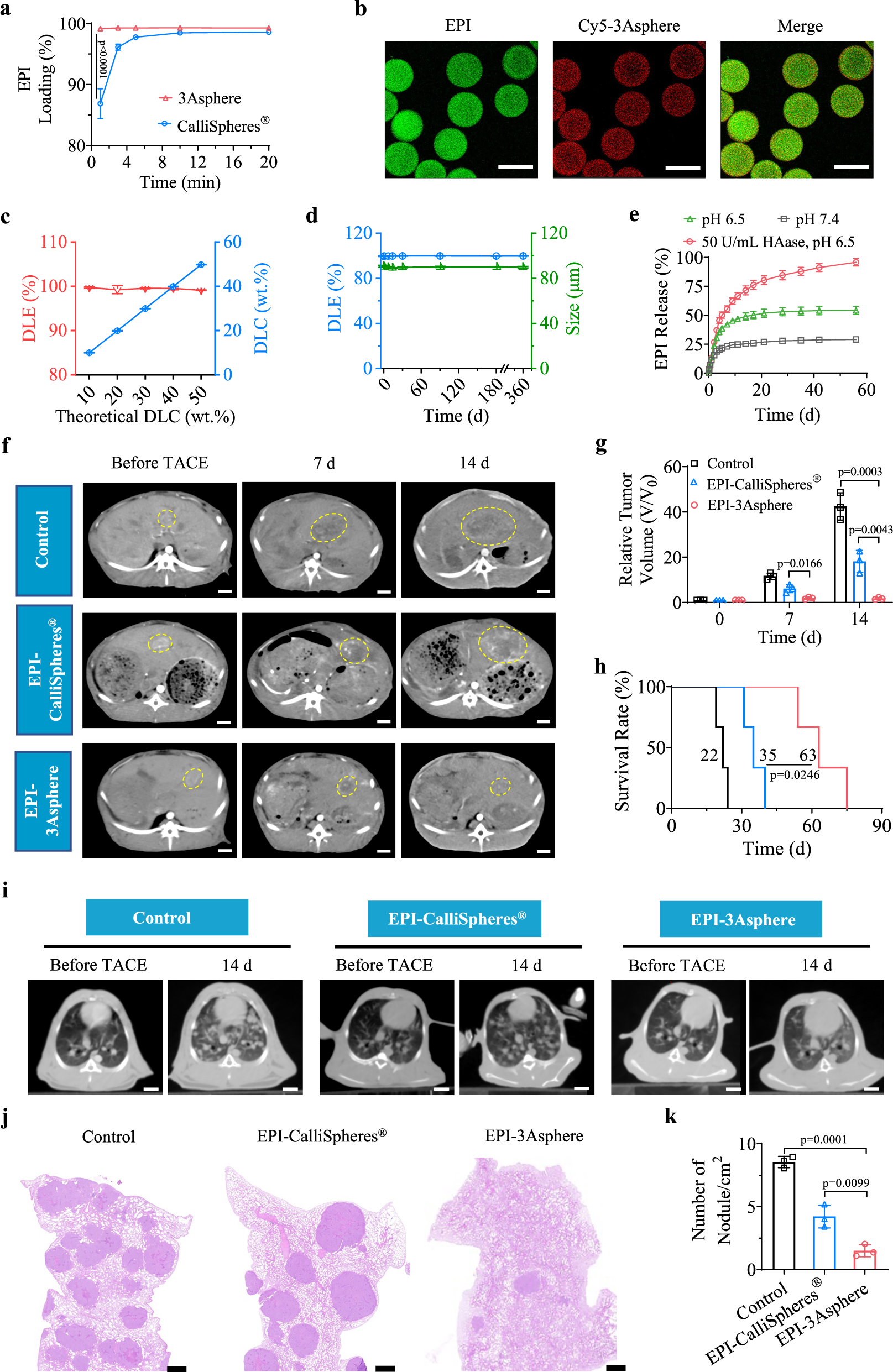 Fig. 7: Transarterial chemoembolization (TACE) using epirubicin-loaded 3Asphere (EPI-3Asphere).