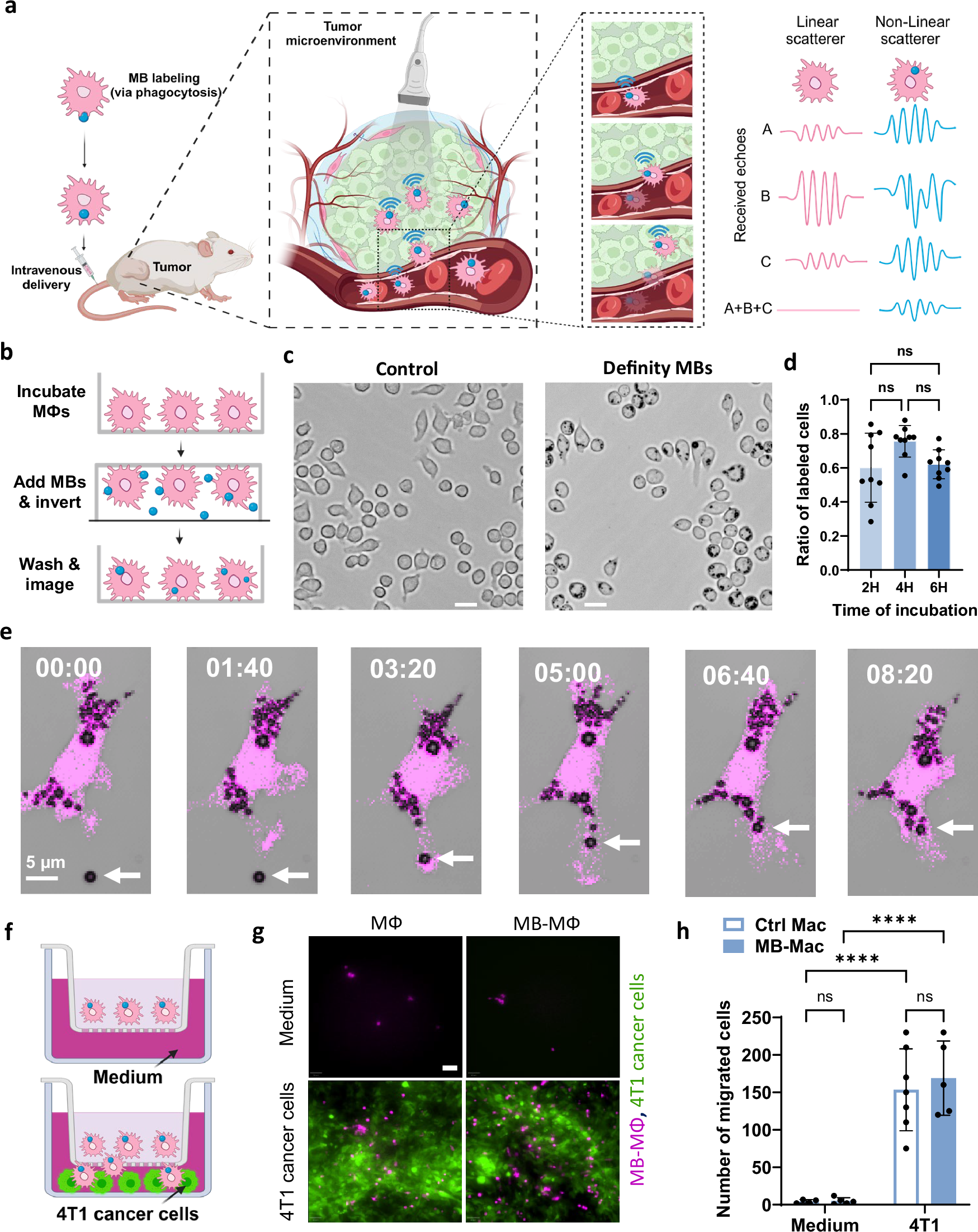 Fig. 1: Macrophages can be labeled with microbubbles with high efficiency and without affecting their migration capability.
