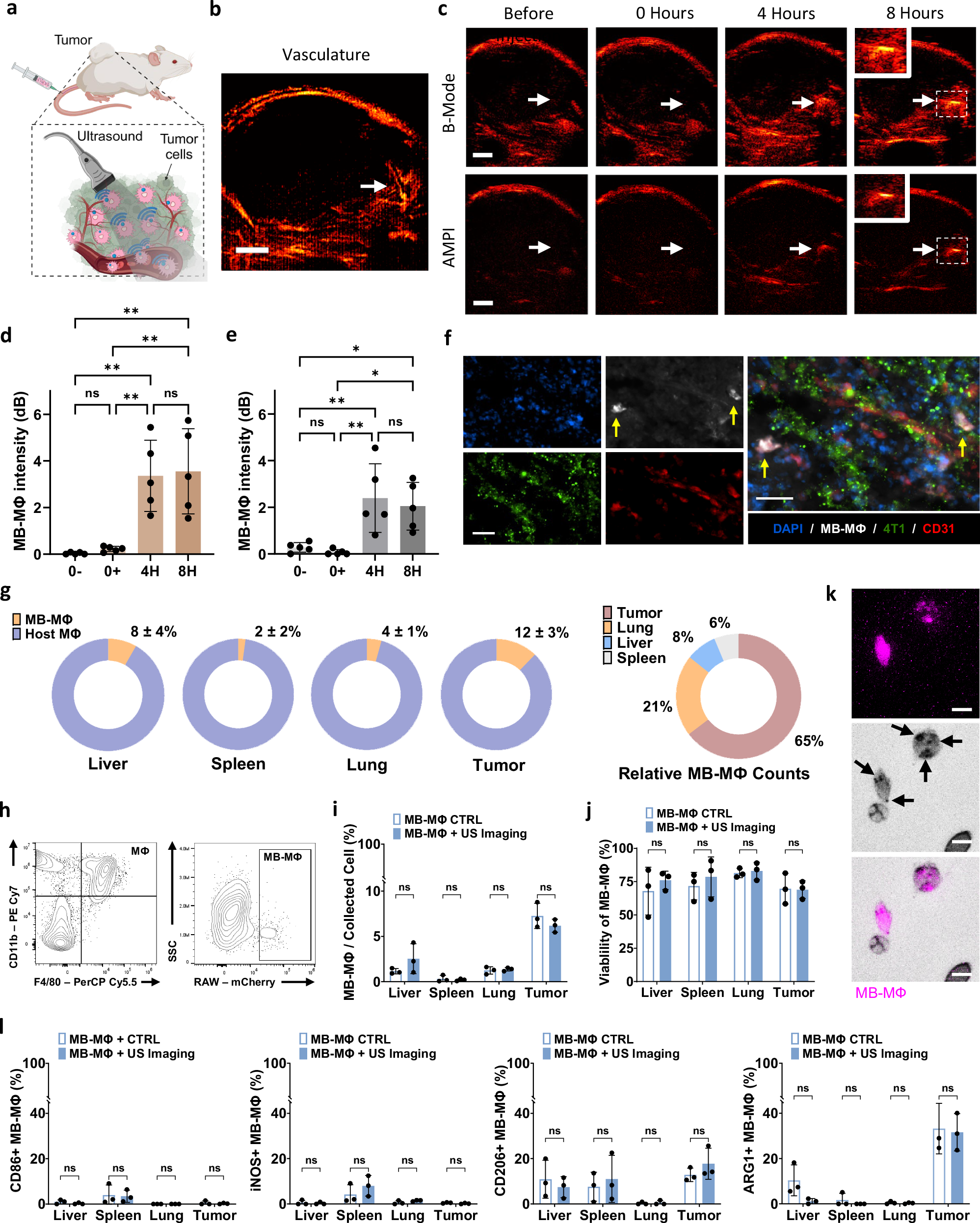 Fig. 8: Assessment of the trafficking patterns of intravenously infused MB-labeled macrophages in solid tumors with US.