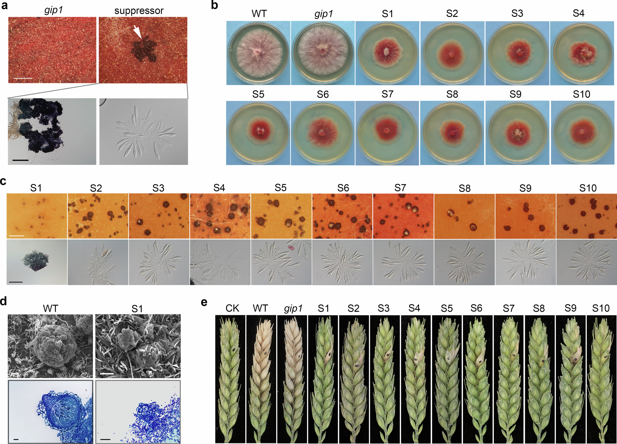 Fig. 5: The isolation and subsequent characterization of spontaneous suppressors of the gip1 mutant.