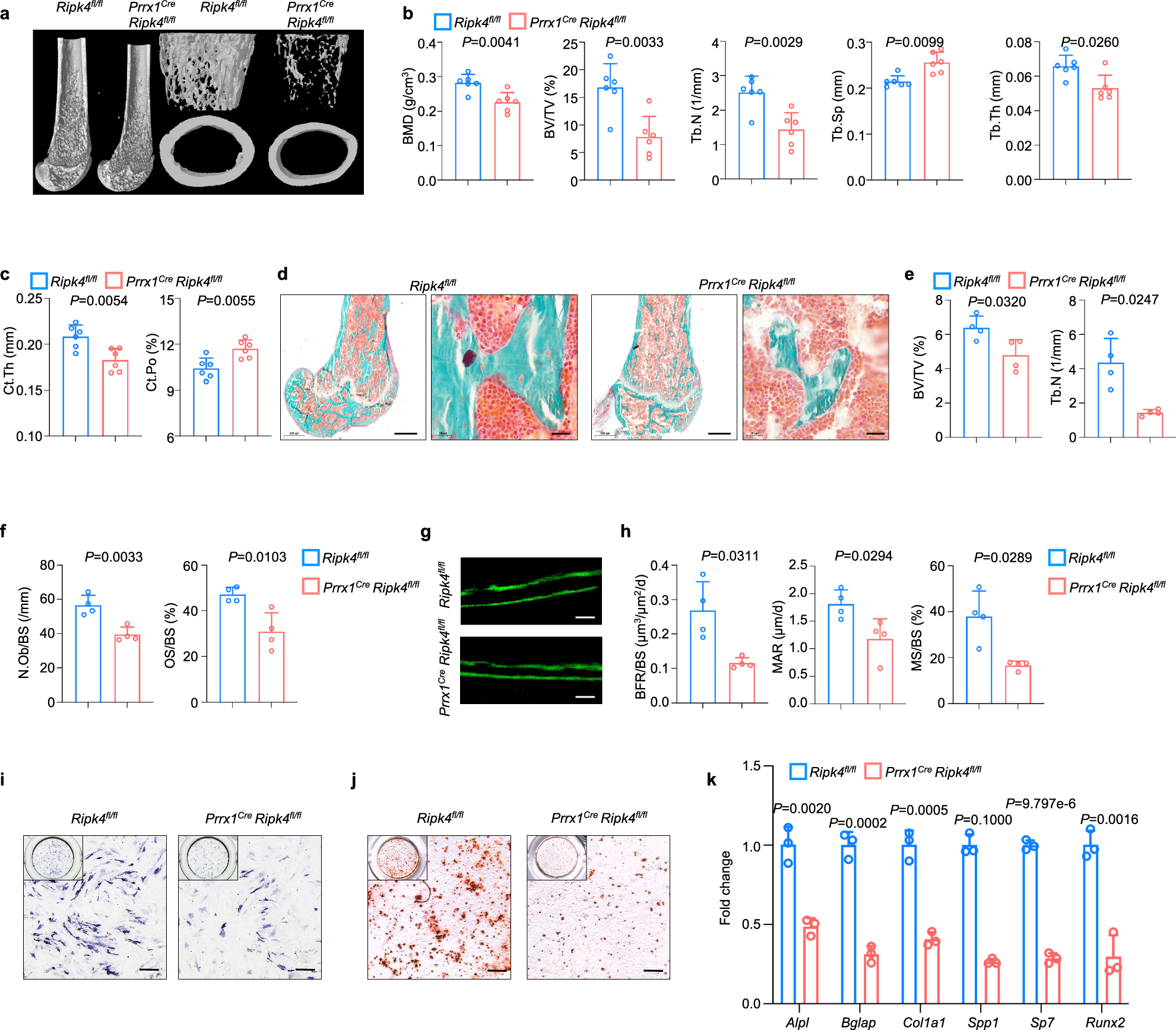 Fig. 3: Osteolineage RIPK4 deficiency impairs osteogenesis.