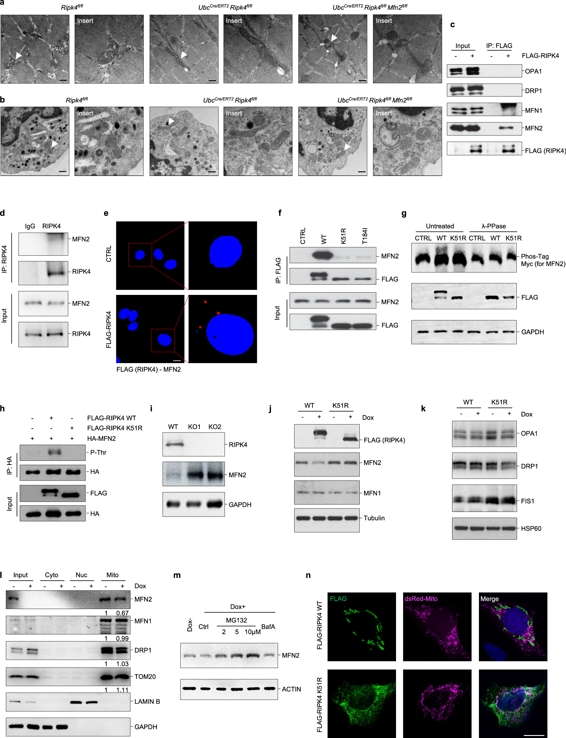 Fig. 5: RIPK4 interacts with MFN2 to regulate mitochondrial dynamics.