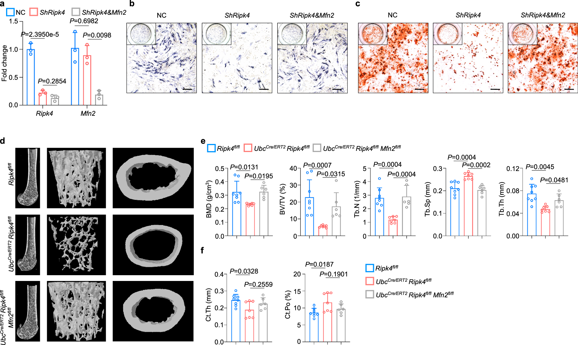 Fig. 6: RIPK4 regulates osteogenesis via MFN2.