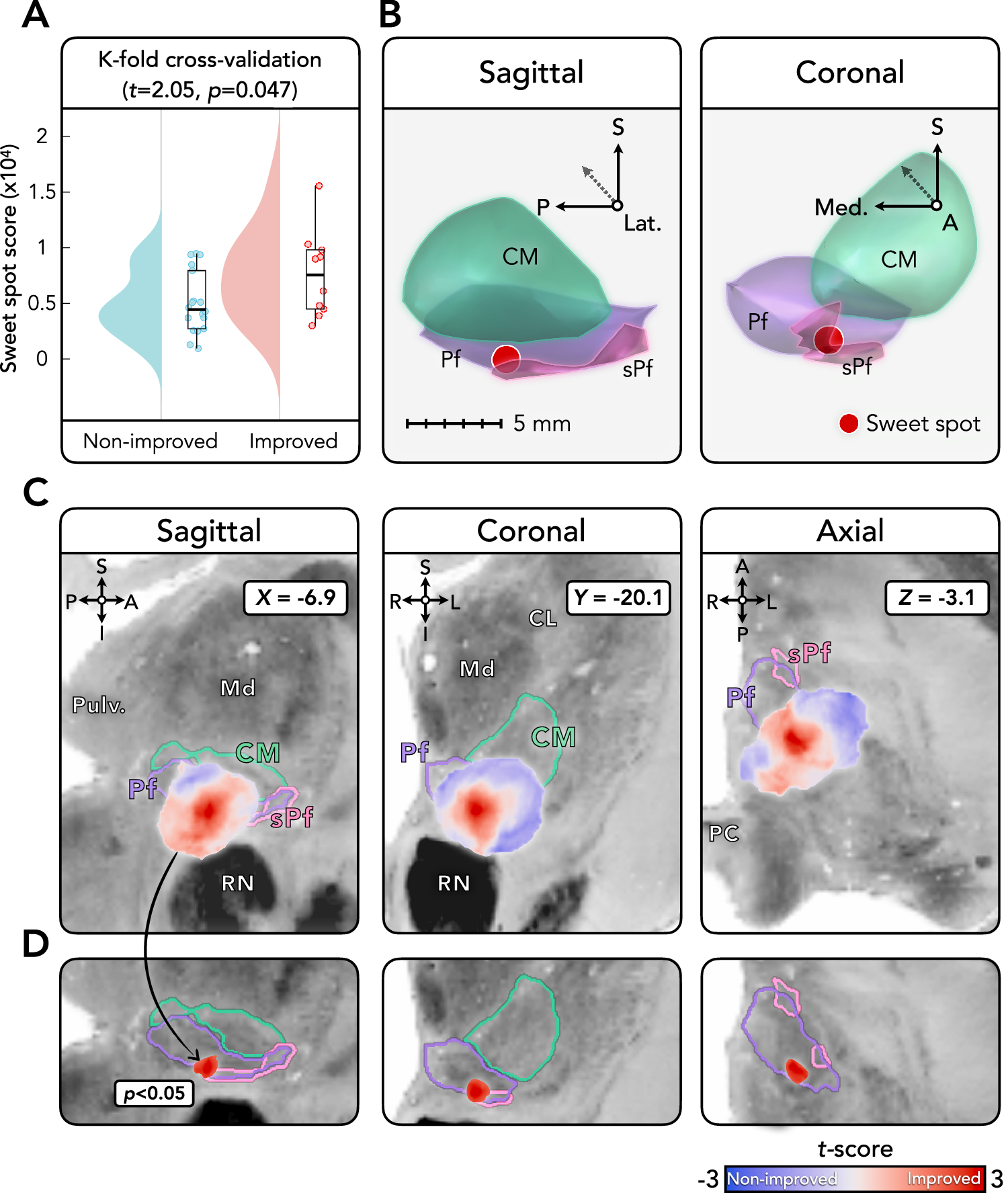 Fig. 3: Anatomical localization and cross-validation of the optimal stimulation site.