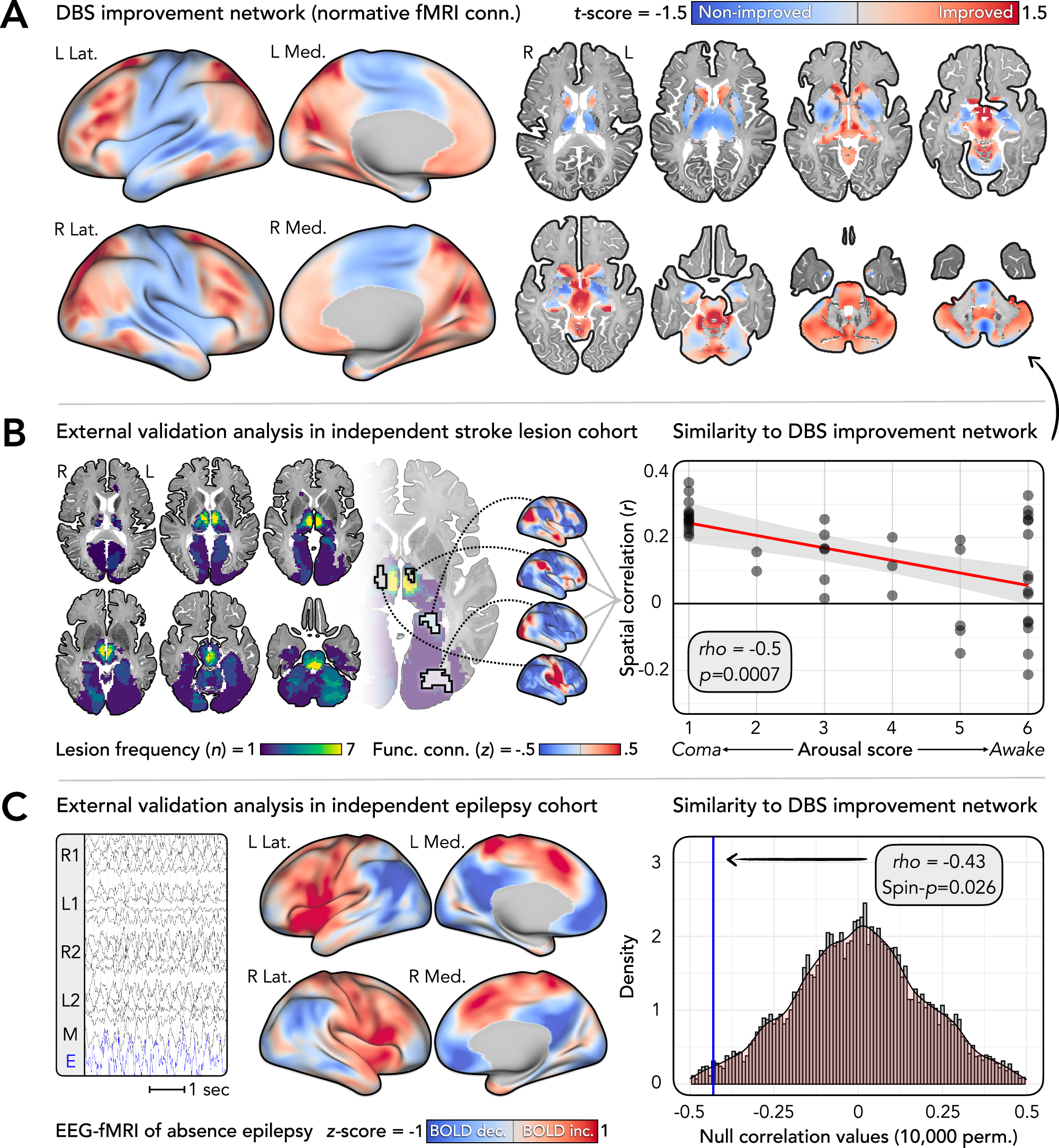Fig. 5: Optimal functional connectivity and alignment with brain networks disrupted in other consciousness-impairing conditions.