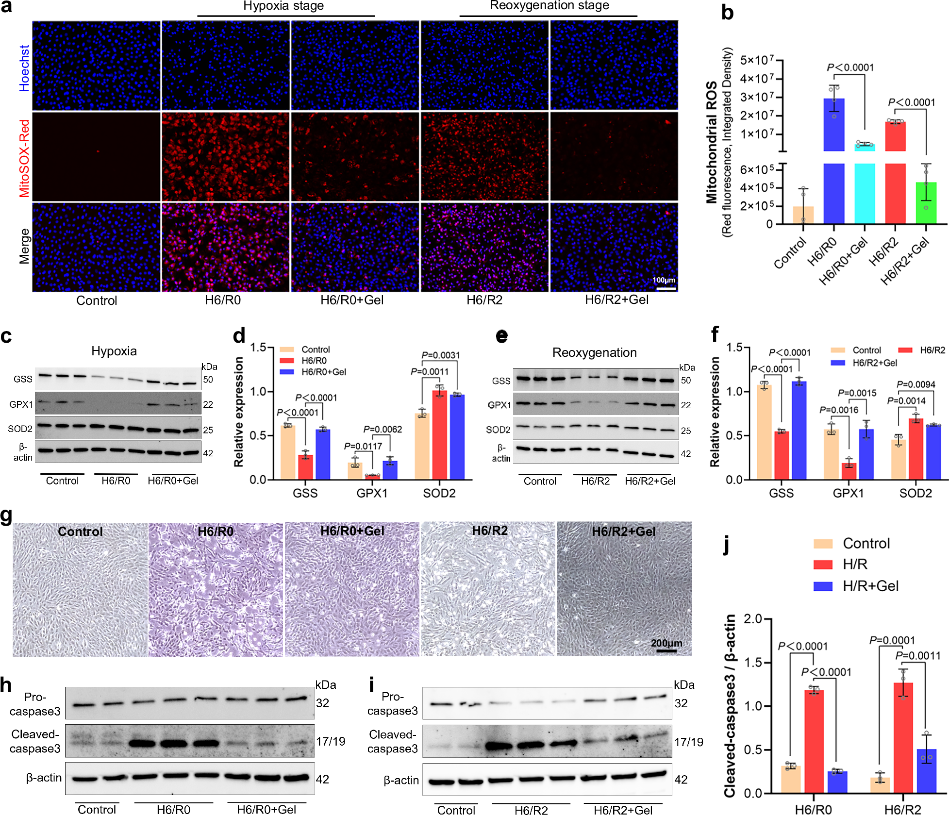 Fig. 3: GA hydrogel reduces H/R-induced ROS generation and cell death.
