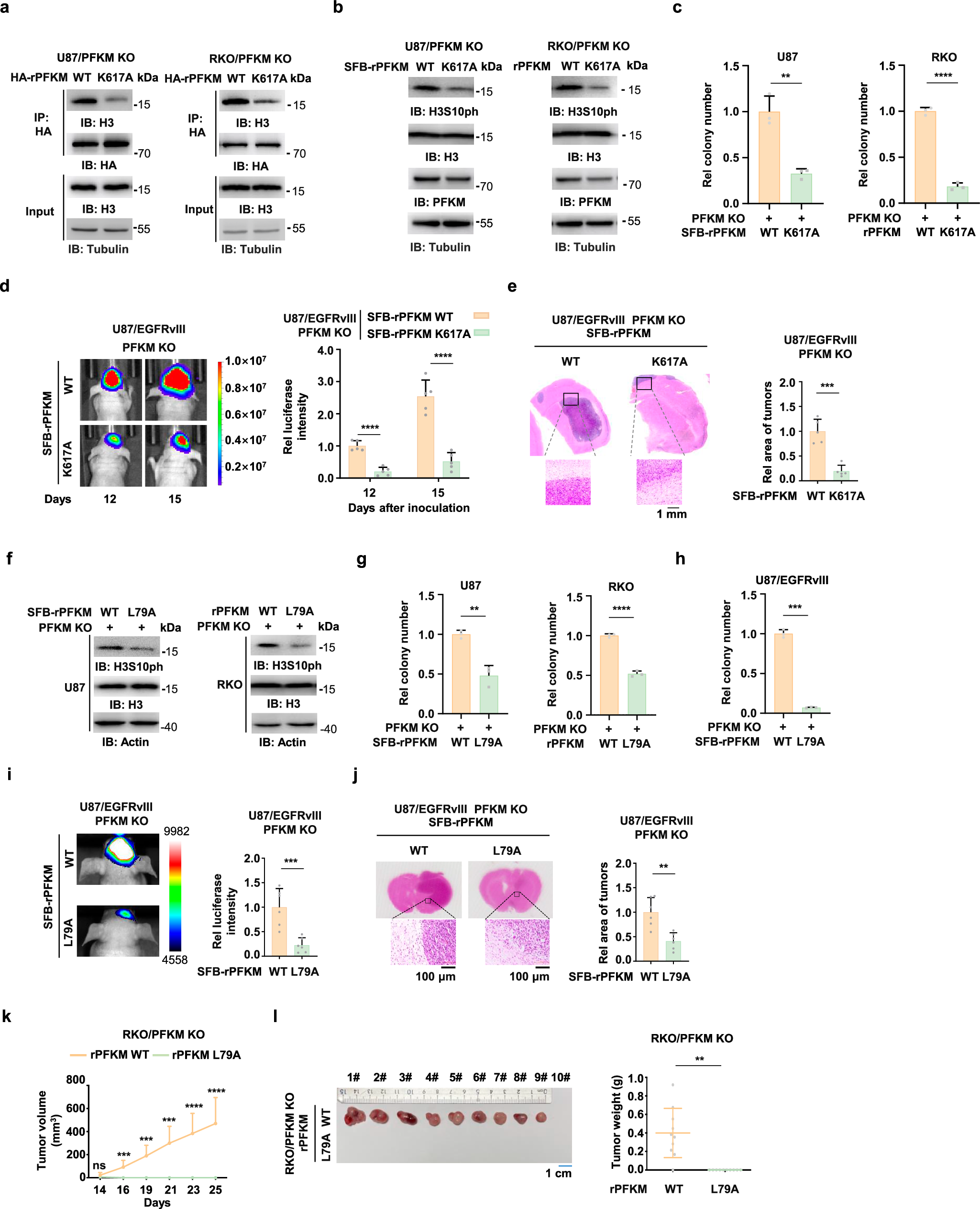 Fig. 5: Citrate-dependent PFKM mediates phosphorylation of histone H3 promotes tumorigenesis.