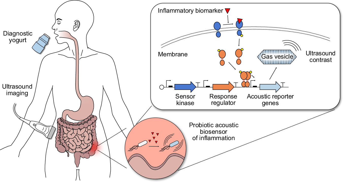 Fig. 1: Concept of probiotic biosensors for ultrasound imaging of gastrointestinal (GI) inflammation.