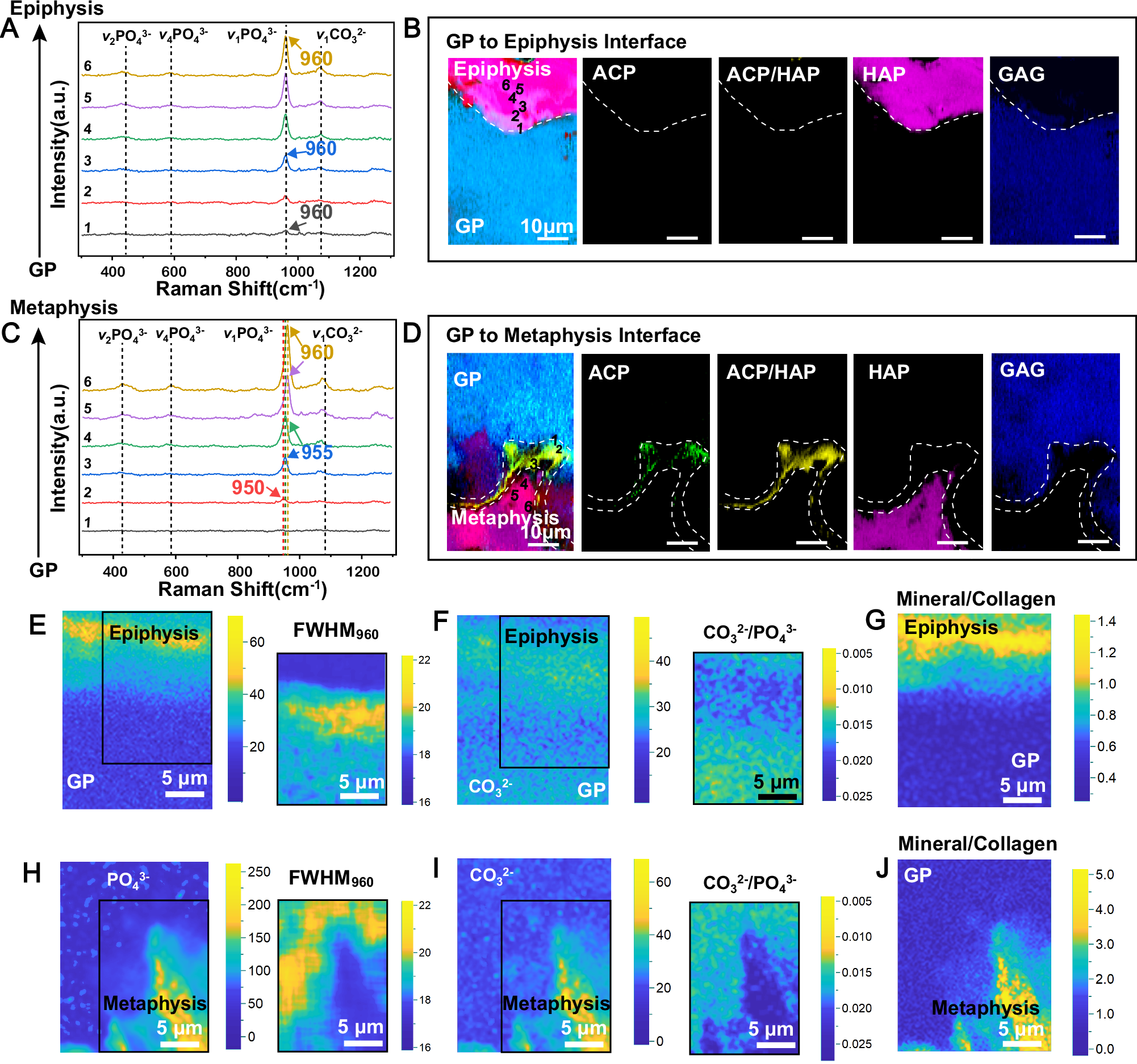 Fig. 3: The chemical distribution maps of the GP-epiphysis interface and GP-metaphysis interface revealed by Raman microscopic detection technology.