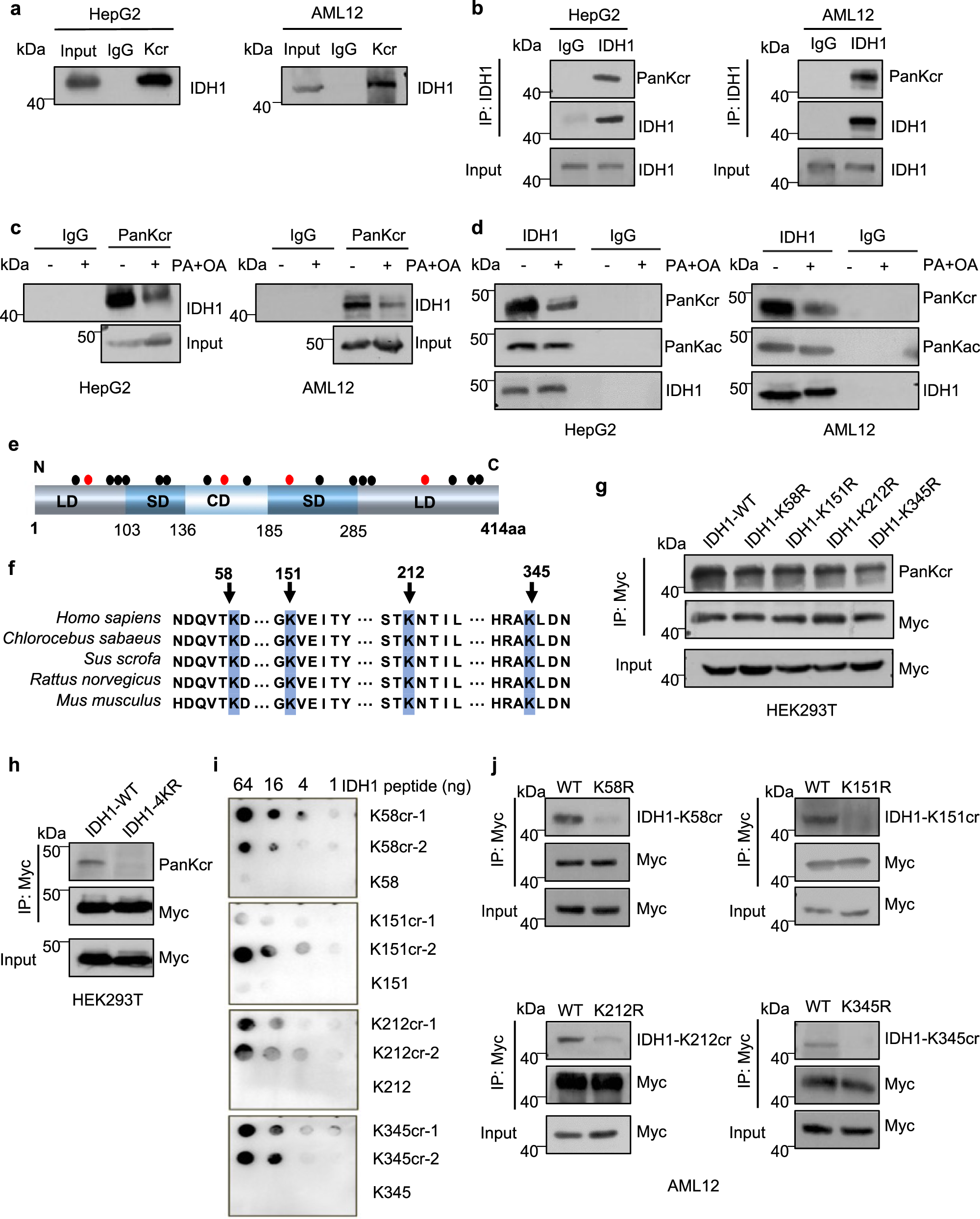 Fig. 3: IDH1 Kcr at K58, K151, K212 and K345 sites decreases upon MASLD.