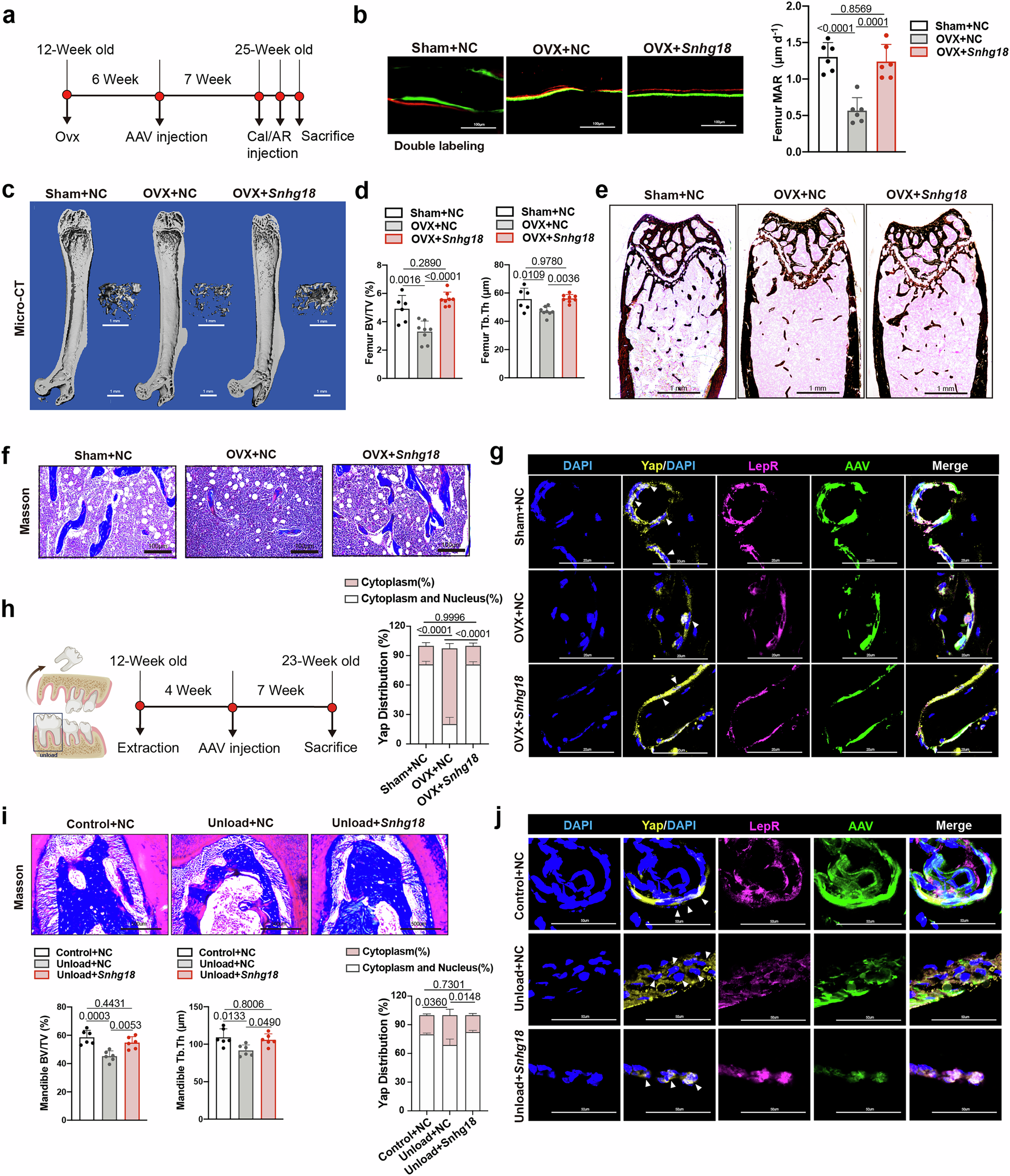 Fig. 7: Snhg18 delivery mitigates bone loss in OVX- and disuse-induced osteoporosis.