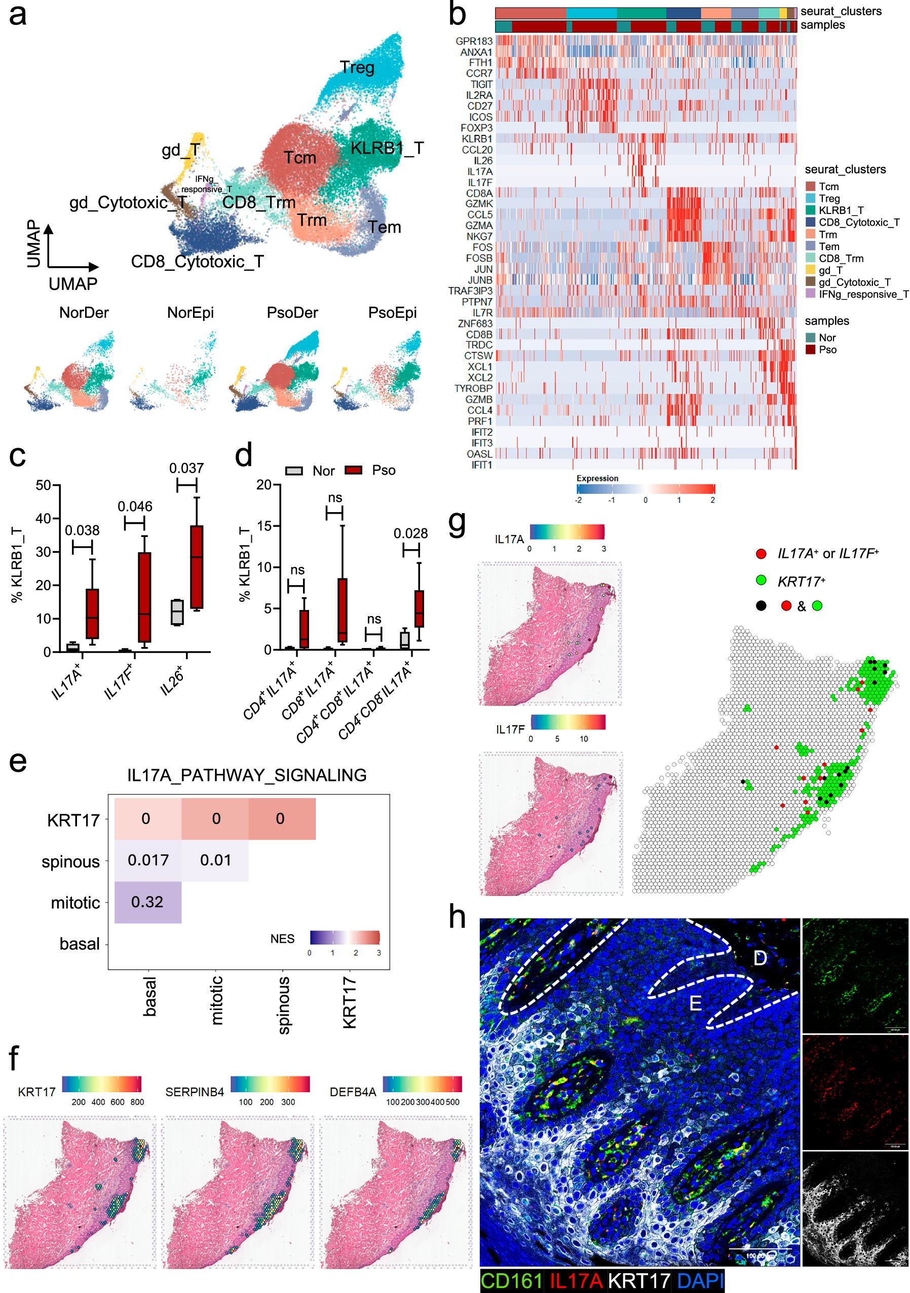 Fig. 1: Altered T cell sub-clusters and type 17 biased response in psoriatic skin.