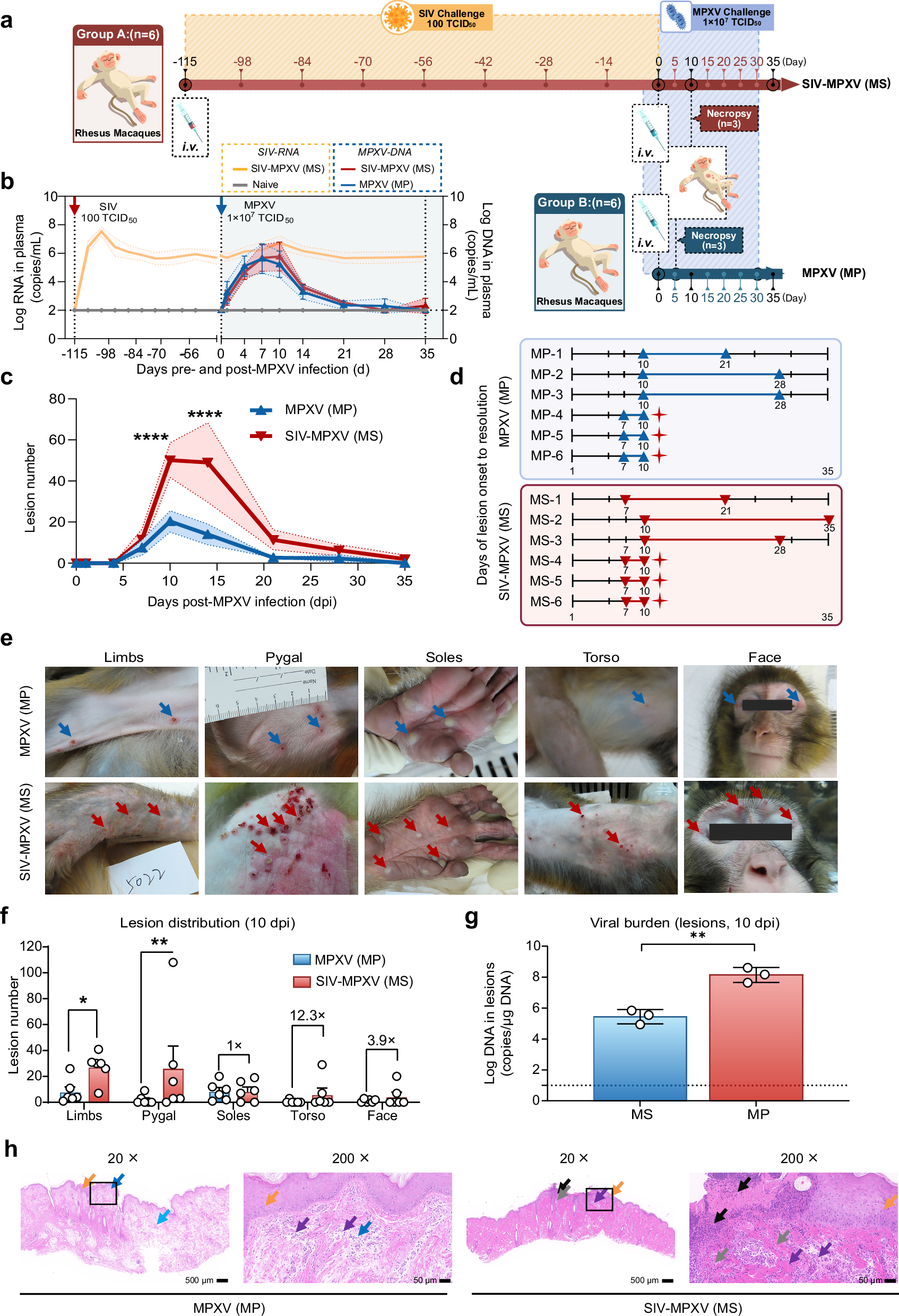 Fig. 1: Study design and comparison of skin lesions in rhesus macaques from the MPXV and SIV-MPXV groups.