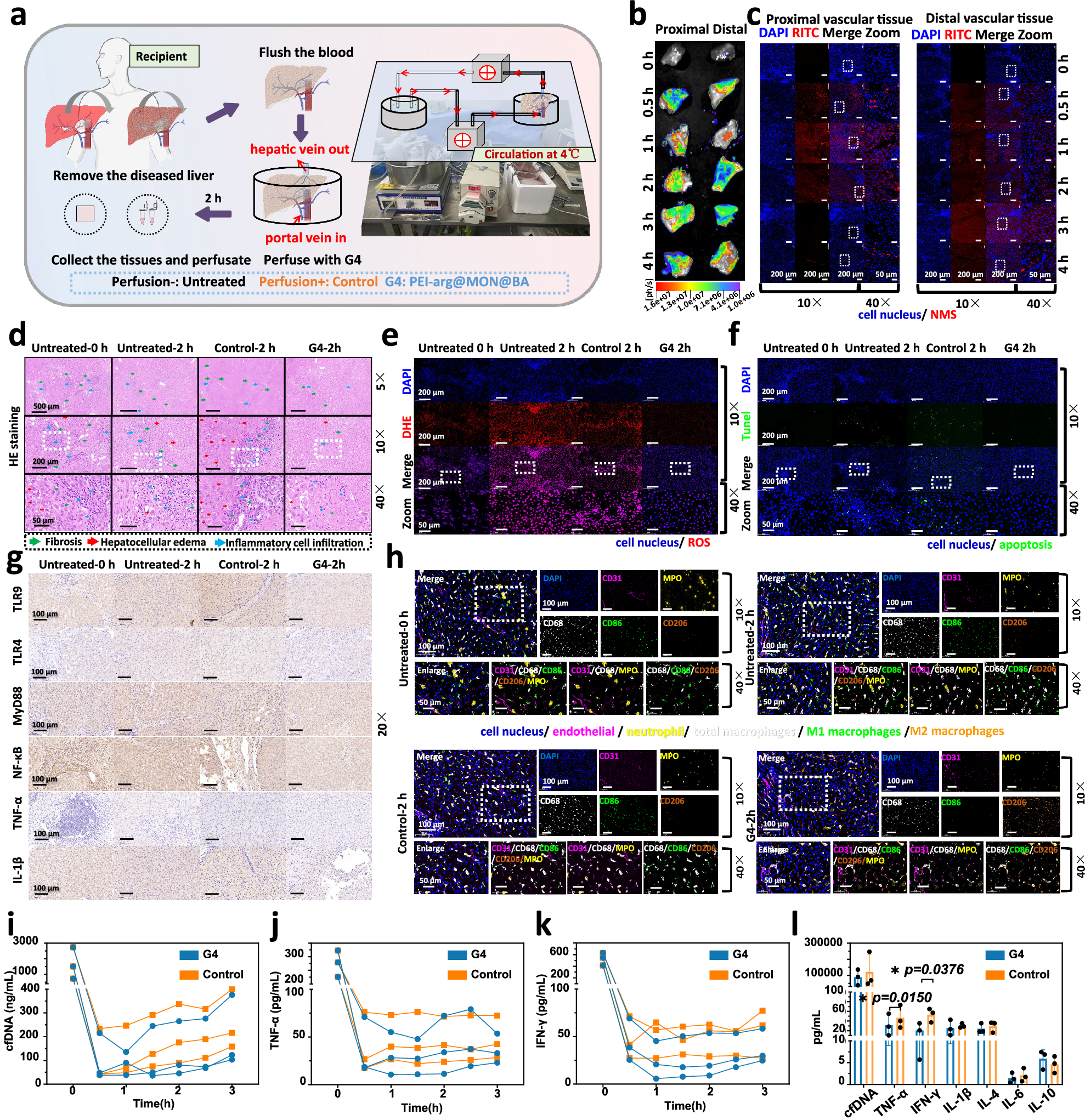Fig. 10: Treatment efficacy of PEI-arg@MON@BA against human ischemic liver.
