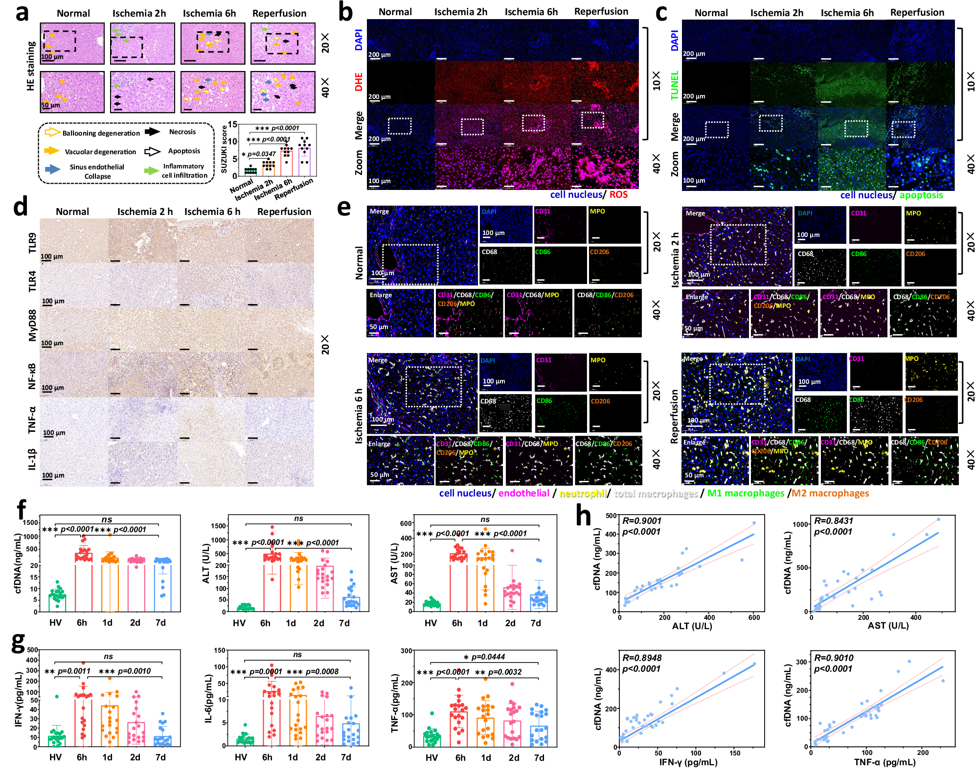 Fig. 2: LT patient samples associated with IRI.