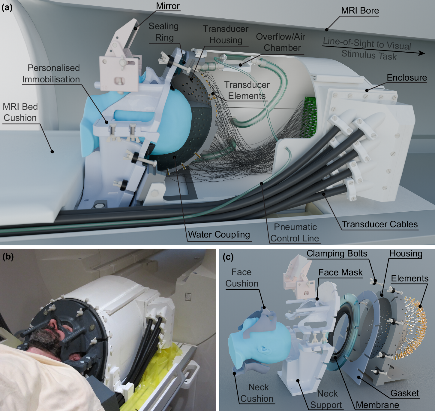 新型超音波ヘルメットで非外科的な深部脳刺激が可能に(New ultrasound helmet enables deep brain stimulation in people without surgery)