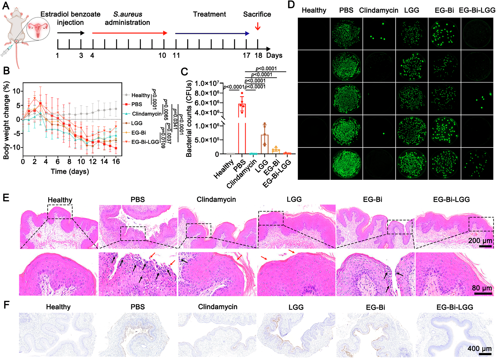 Fig. 7: Value of LSTC in intervening aerobic vaginitis.