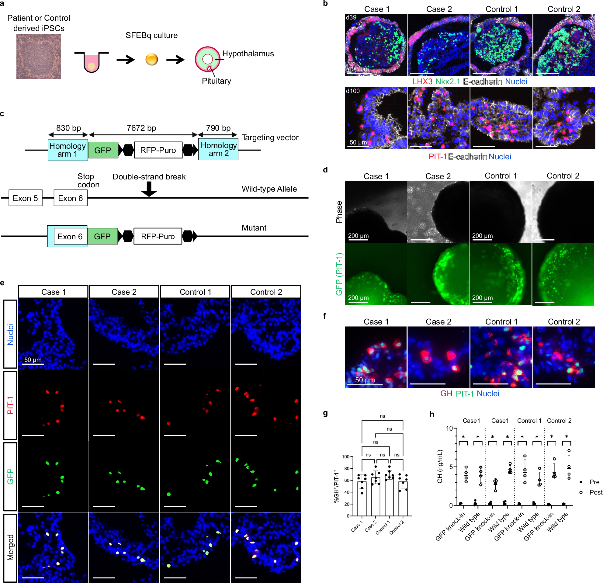 Fig. 2: Regenerating functional PIT-1-expressing pituitary cells from patient-derived induced pluripotent stem cells (iPSCs).
