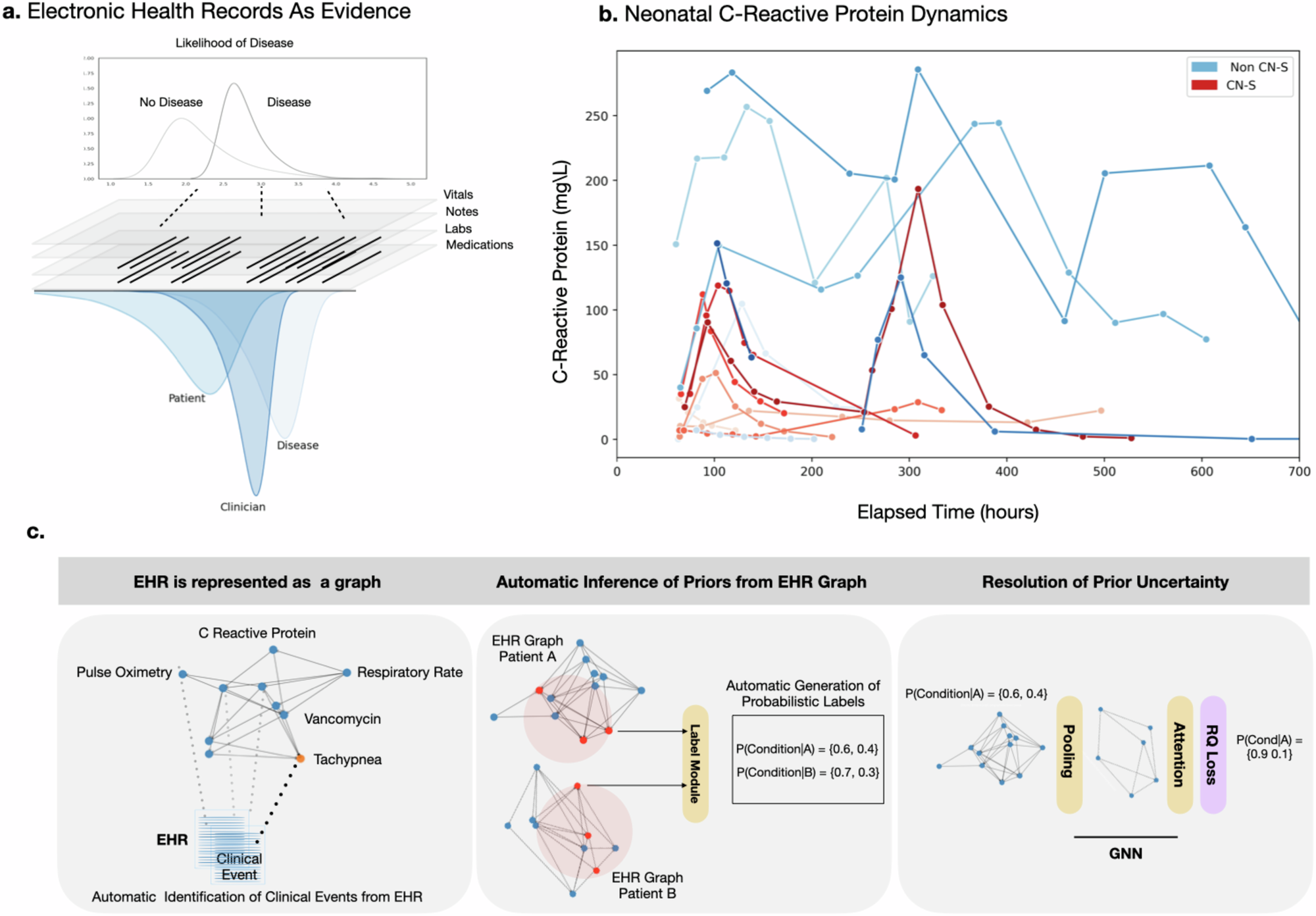 AIが診断支援に重要な手がかりを発見(AI System Finds Crucial Clues for Diagnoses in Electronic Health Records)