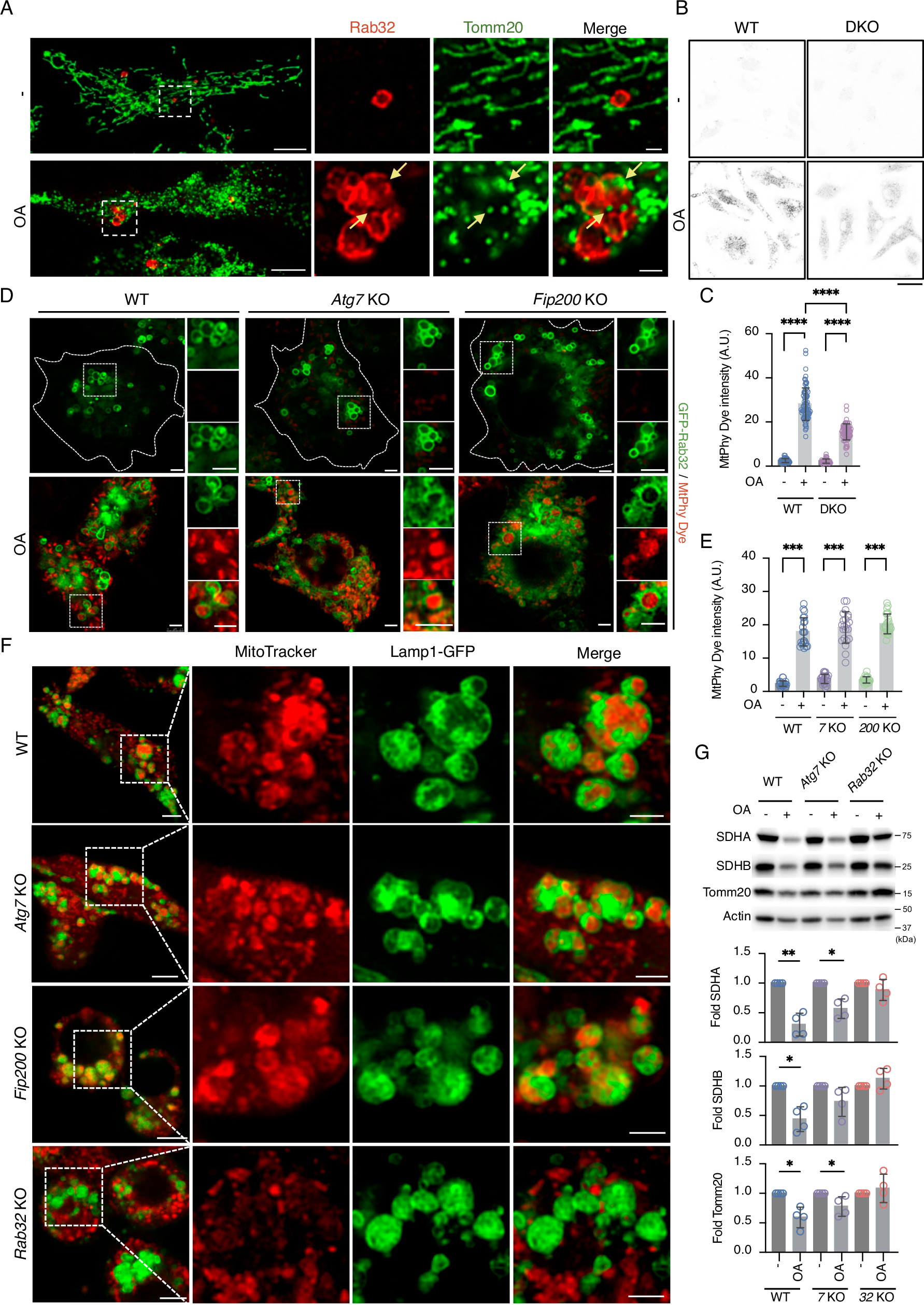 Fig. 2: Evidence for mitophagy in Rab32-positive LRO in macrophages.