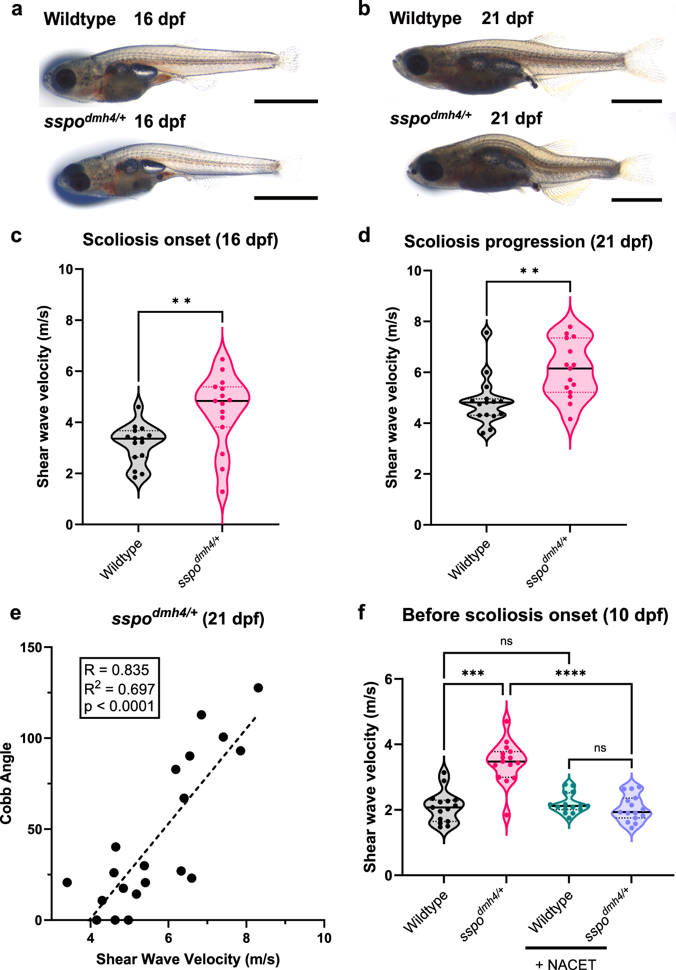 Fig. 5: Elevated spine stiffness is observed prior to scoliosis onset, positively correlates with curve severity, and is fully suppressed by antioxidant therapy.