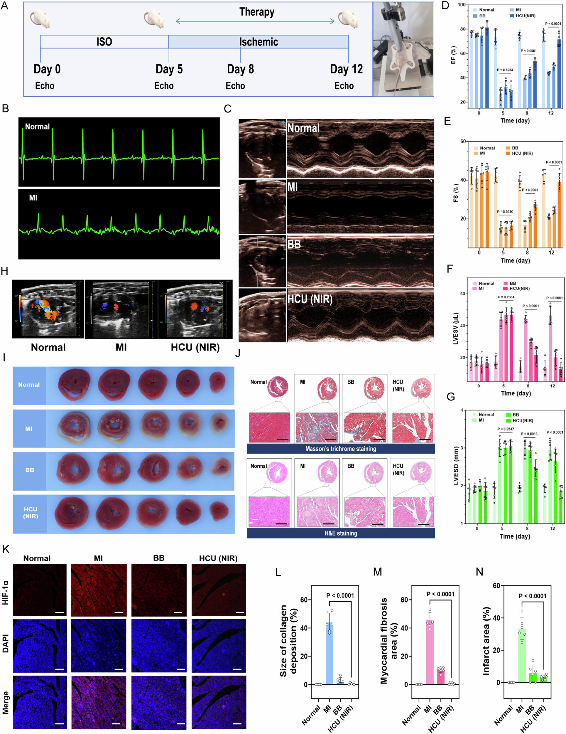 Fig. 6: In vivo therapeutic efficacy of photosynthetic system in myocardial ischemia mice.