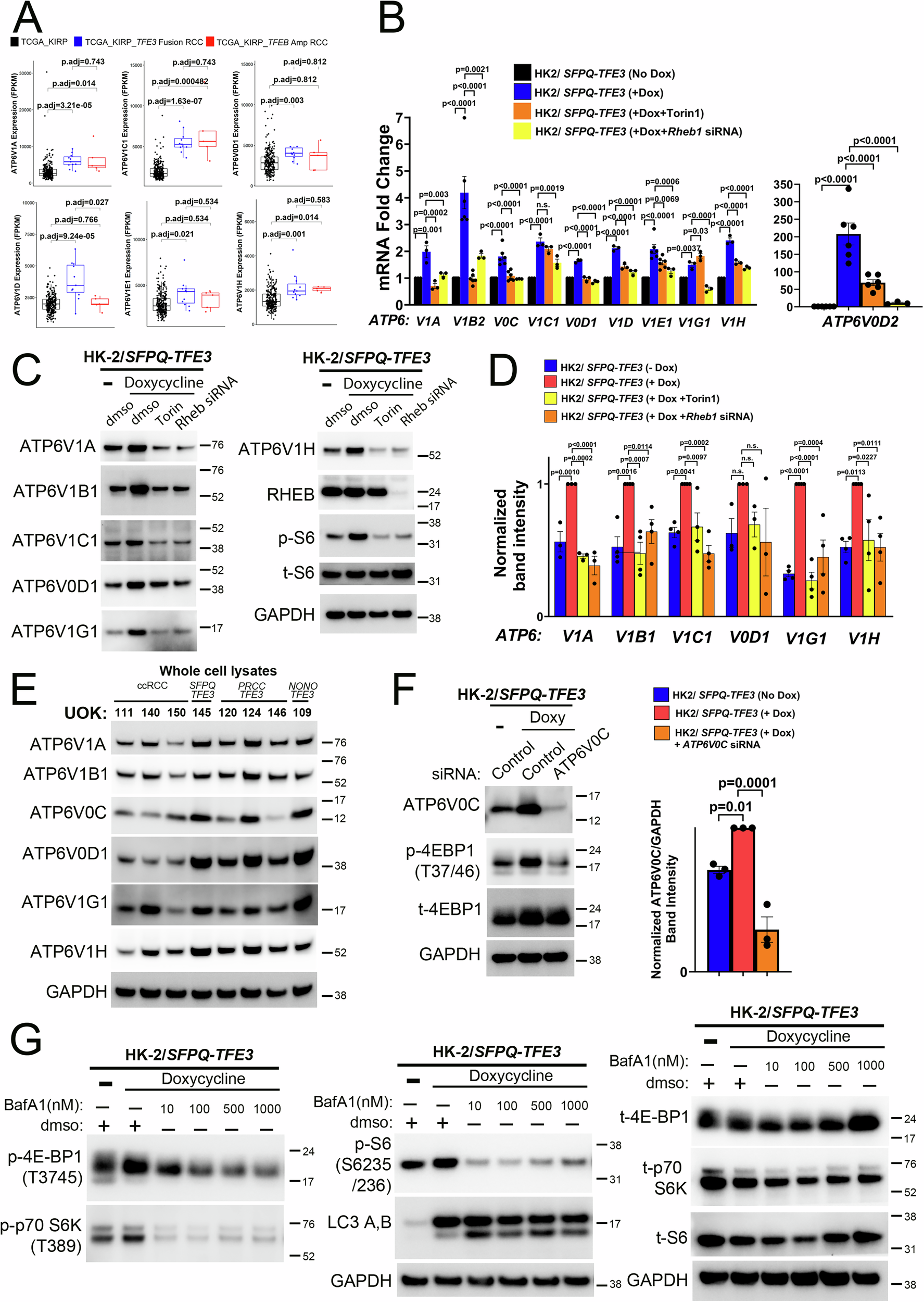 Fig. 4: mTORC1 signaling is activated in murine and human models of SFPQ-TFE3 fusion-RCC.