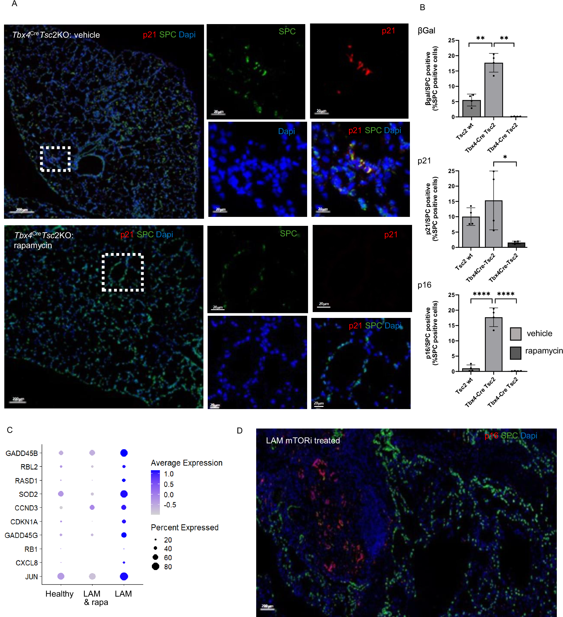 Fig. 5: AT2 cell senescence is mTOR dependent.