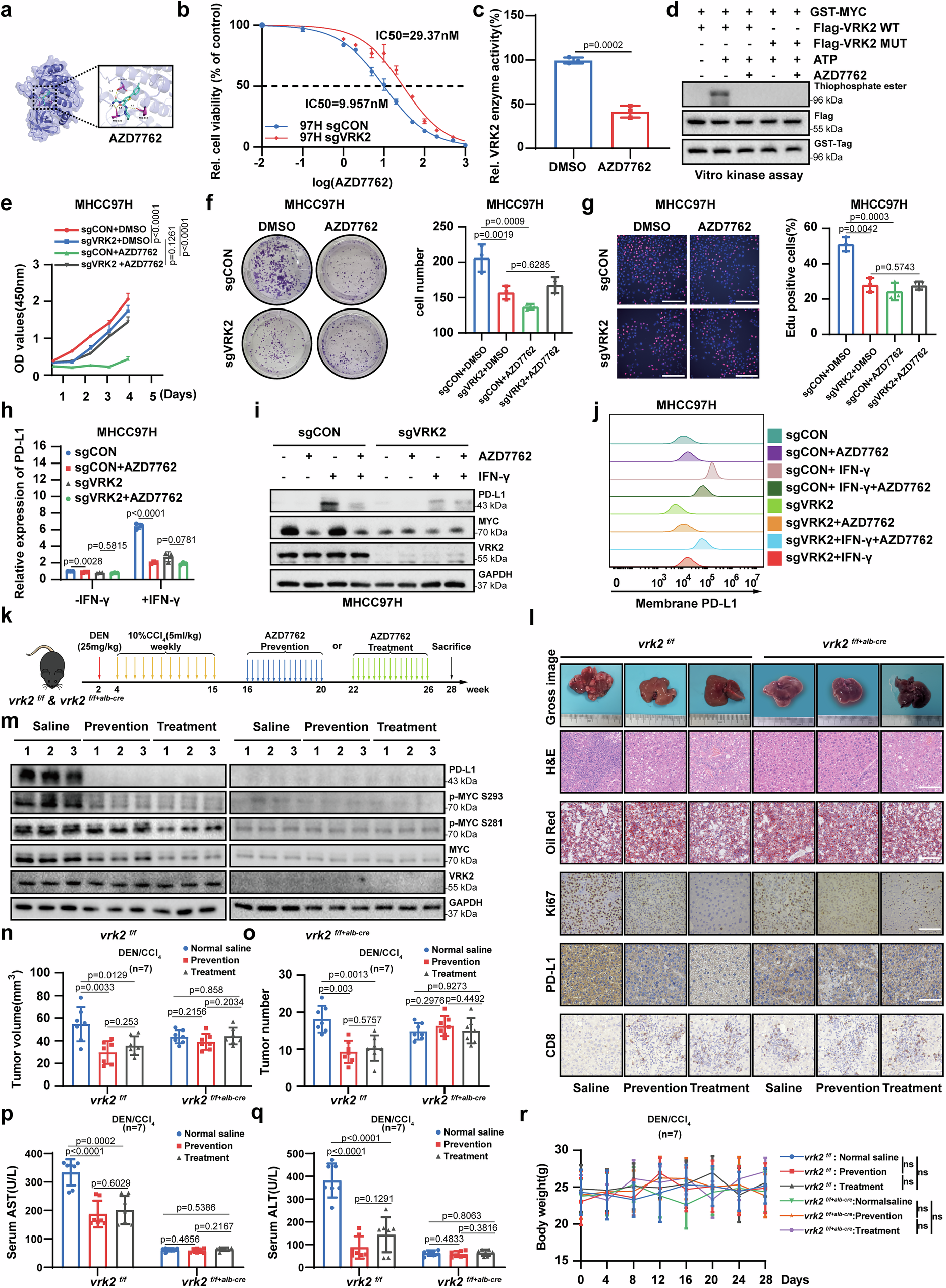 Fig. 6: AZD7762, a small molecular inhibitor of VRK2, can reduces HCC growth.