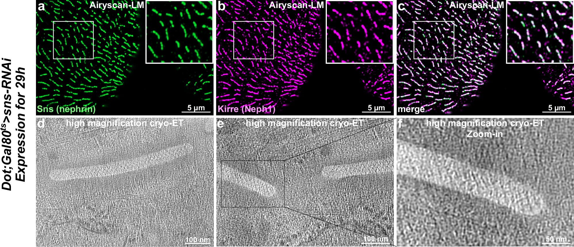 Fig. 4: Reduction of Sns to intermediate levels reveals shorter slit diaphragm (SD) lines, while the fishnet architecture of the SD remains.