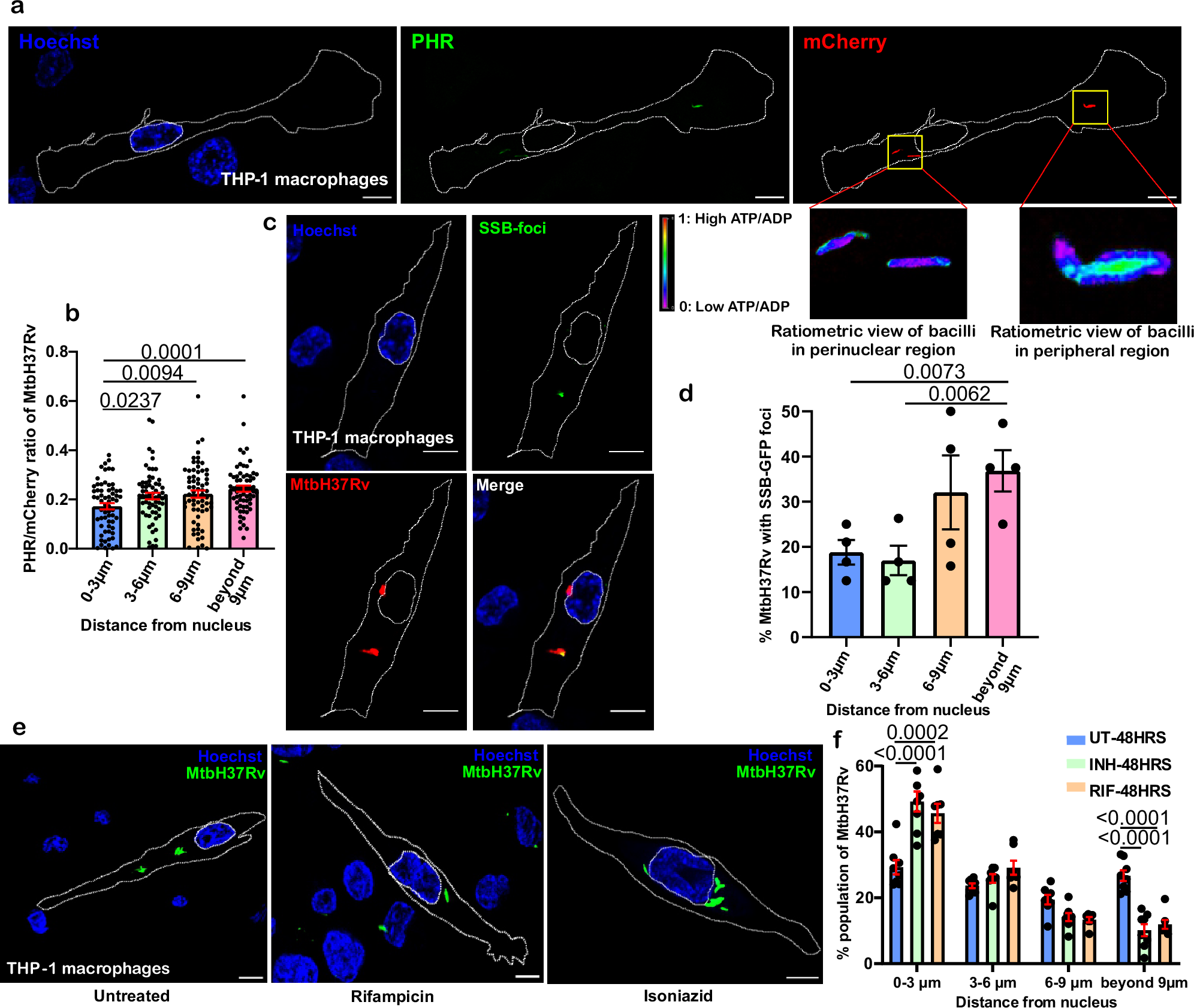 Fig. 2: Subcellular localization of intracellular M. tuberculosis governs its bioenergetic state, replication rate, and response to drugs.