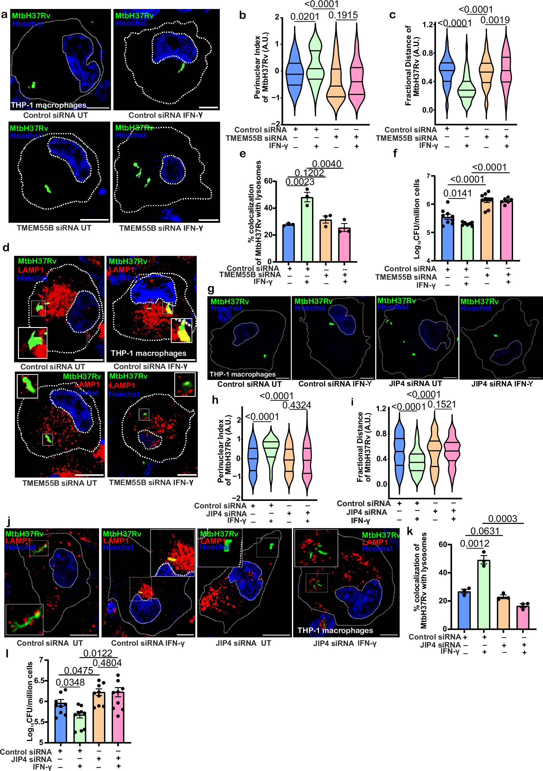 Fig. 7: TFEB-TMEM55B-JIP4 axis drives retrograde lysosomal trafficking mediated by IFN-γ.