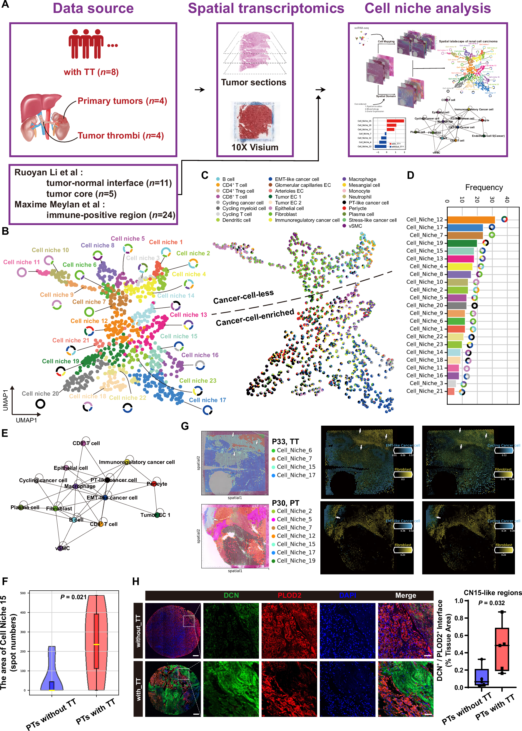 Fig. 2: Spatial characterization of renal cell carcinoma (RCC) through integrative spatial transcriptomics analysis.