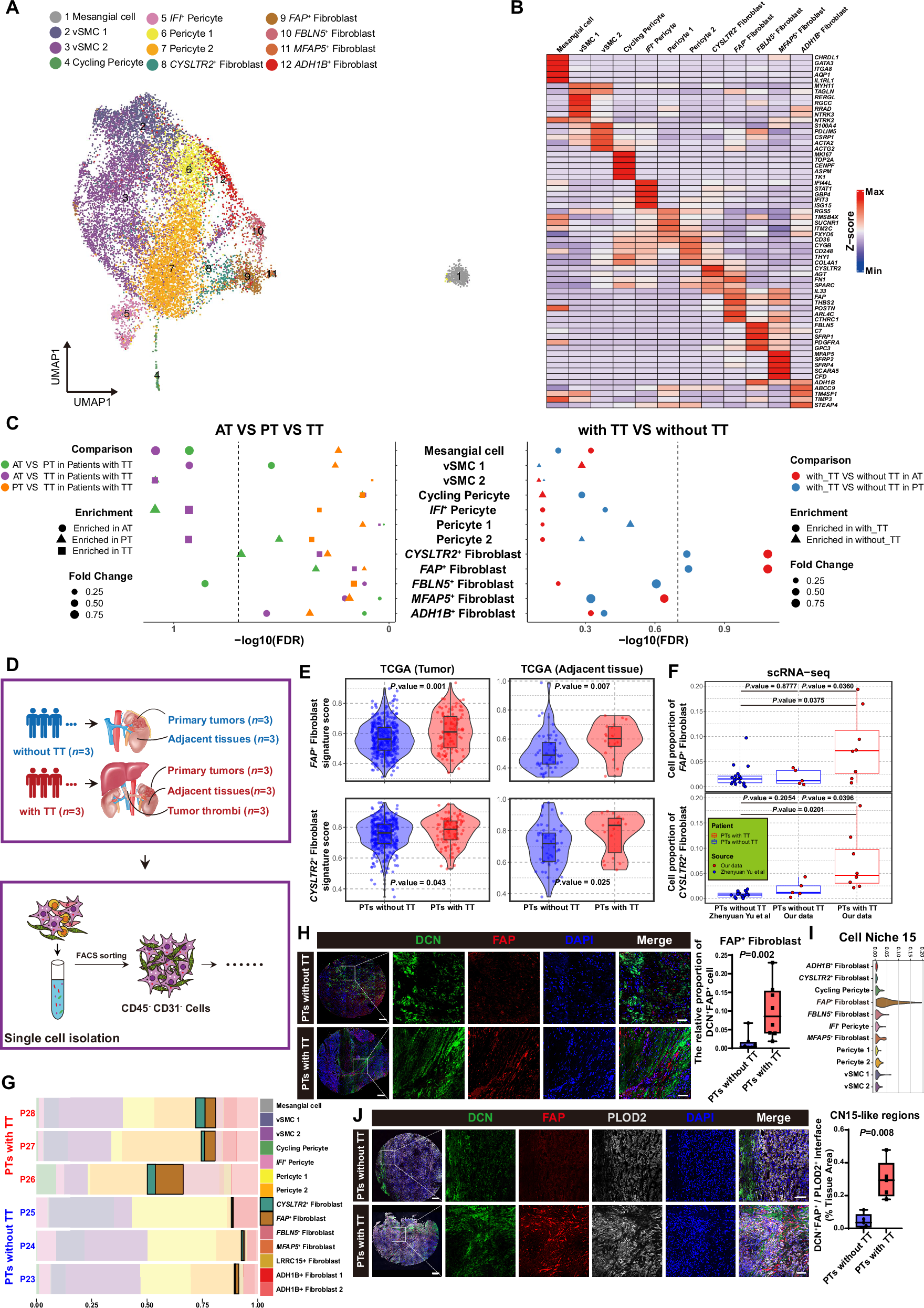 Fig. 3: Stromal remodeling during RCC tumorigenesis and TT formation.