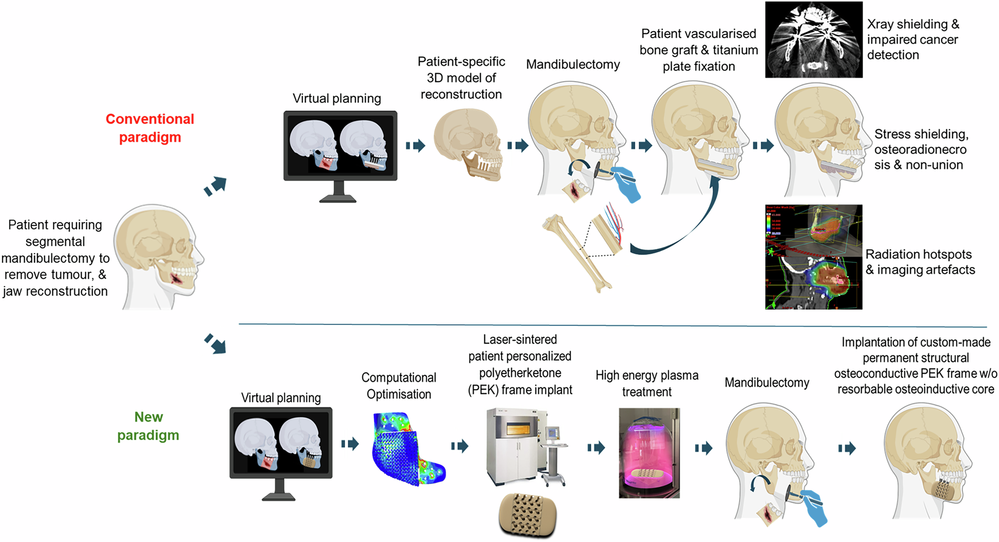 Fig. 1: A new paradigm in patient-matched scaffold-guided bone regeneration.