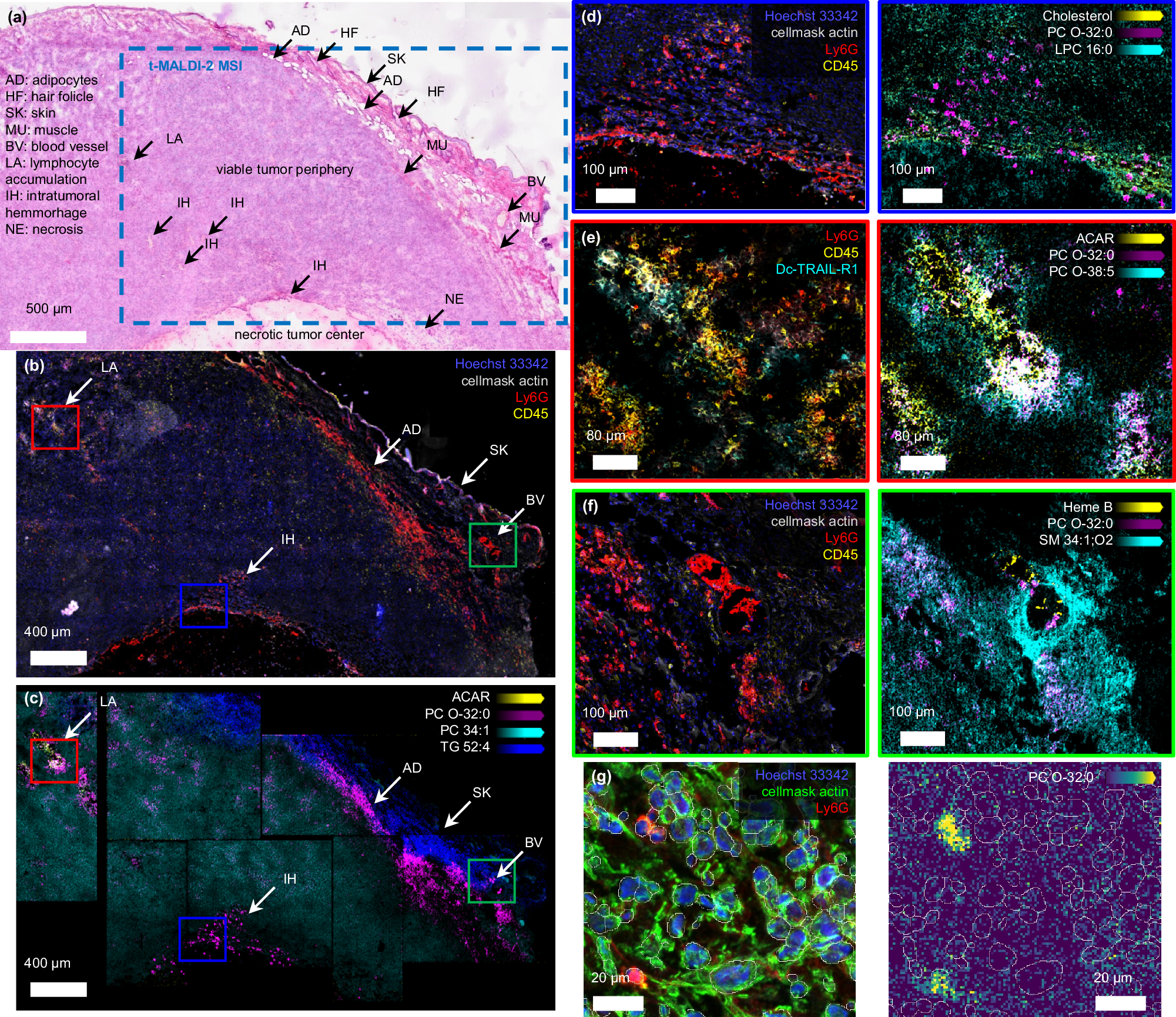 Fig. 5: Automated single-cell analysis of lipids in their histological tissue context.