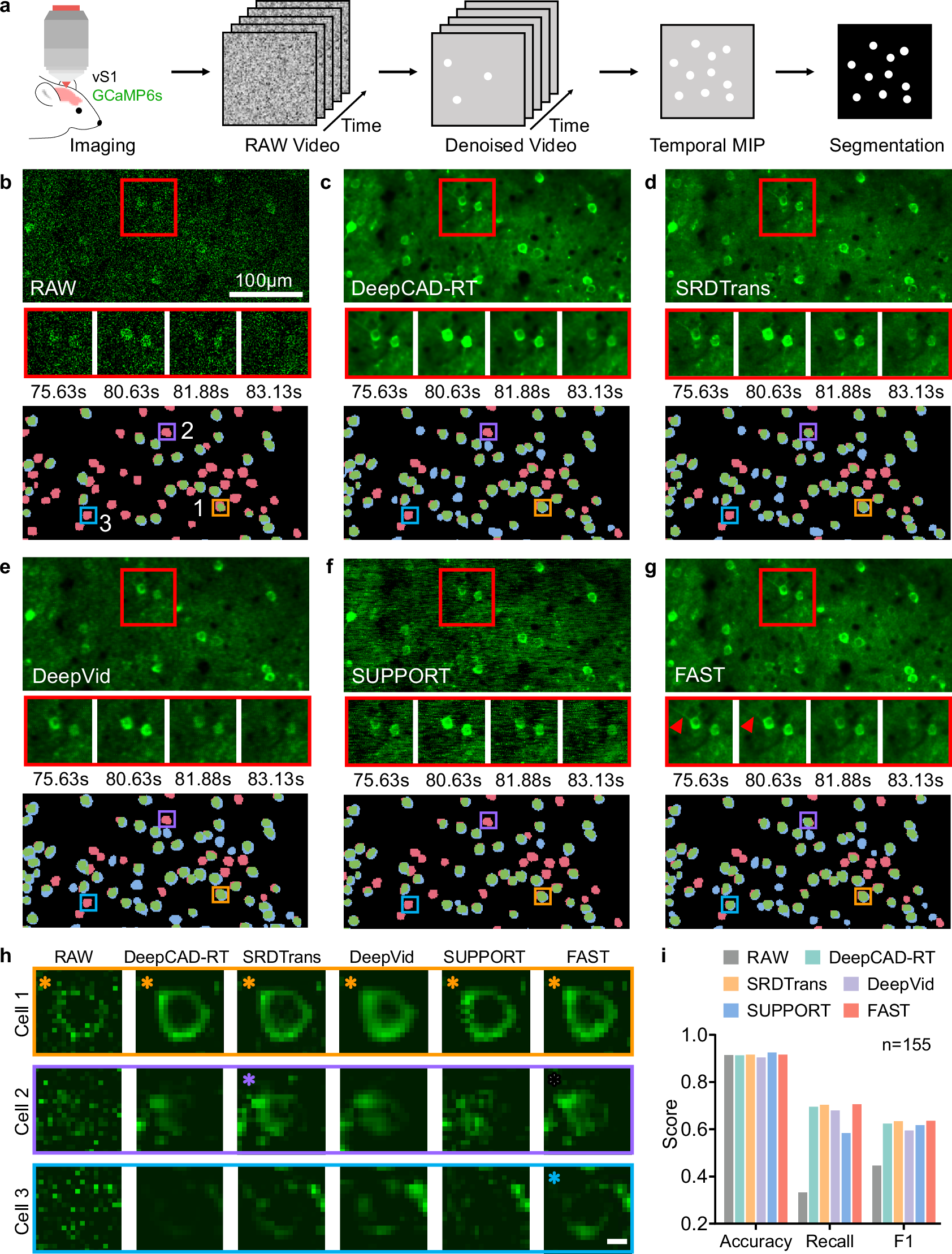 Fig. 2: FAST enhances Ca2+ imaging quality and analytical accuracy.