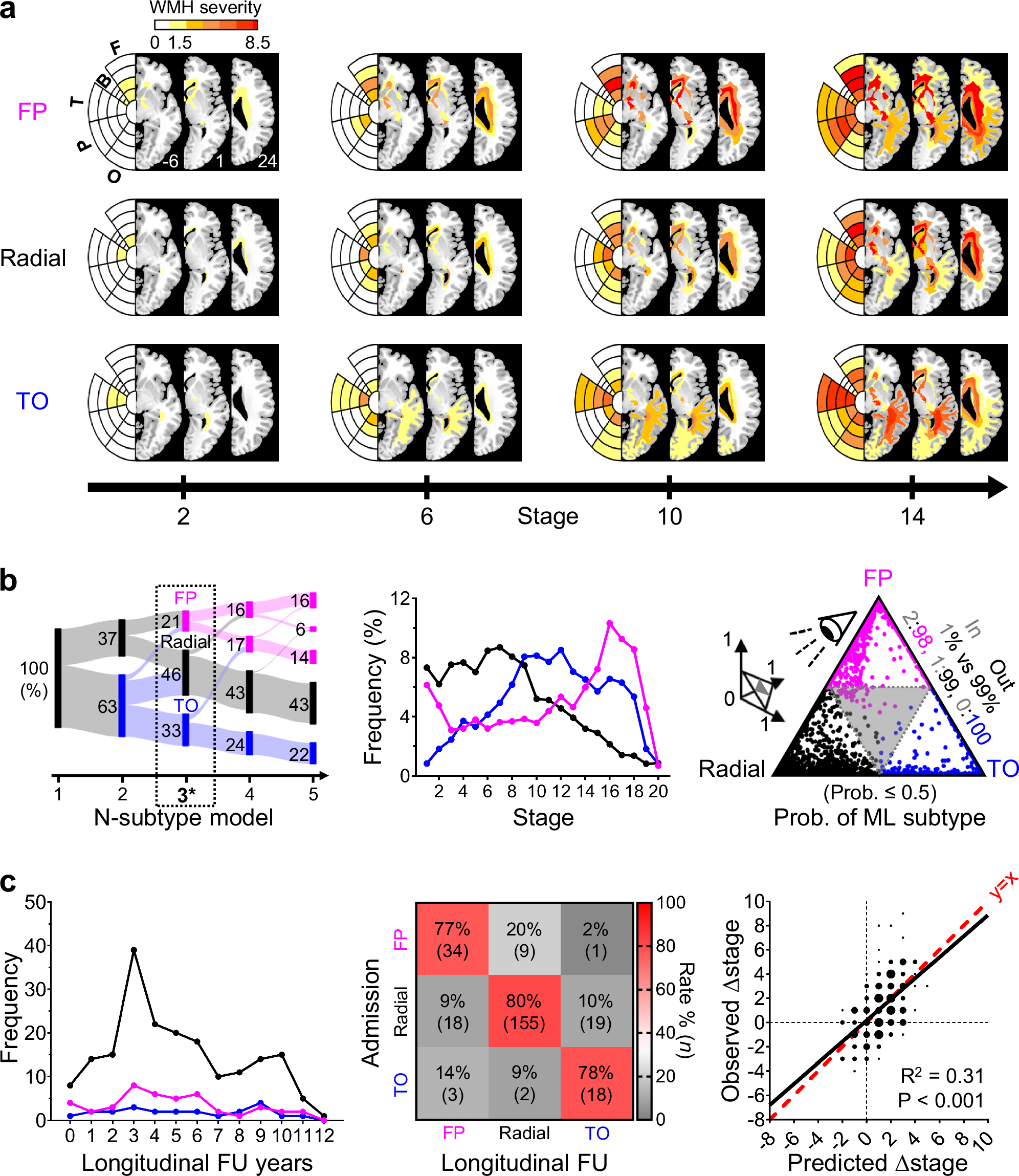 Fig. 1: Distinct spatiotemporal trajectories of white matter hyperintensity (WMH) progression in stroke patients.