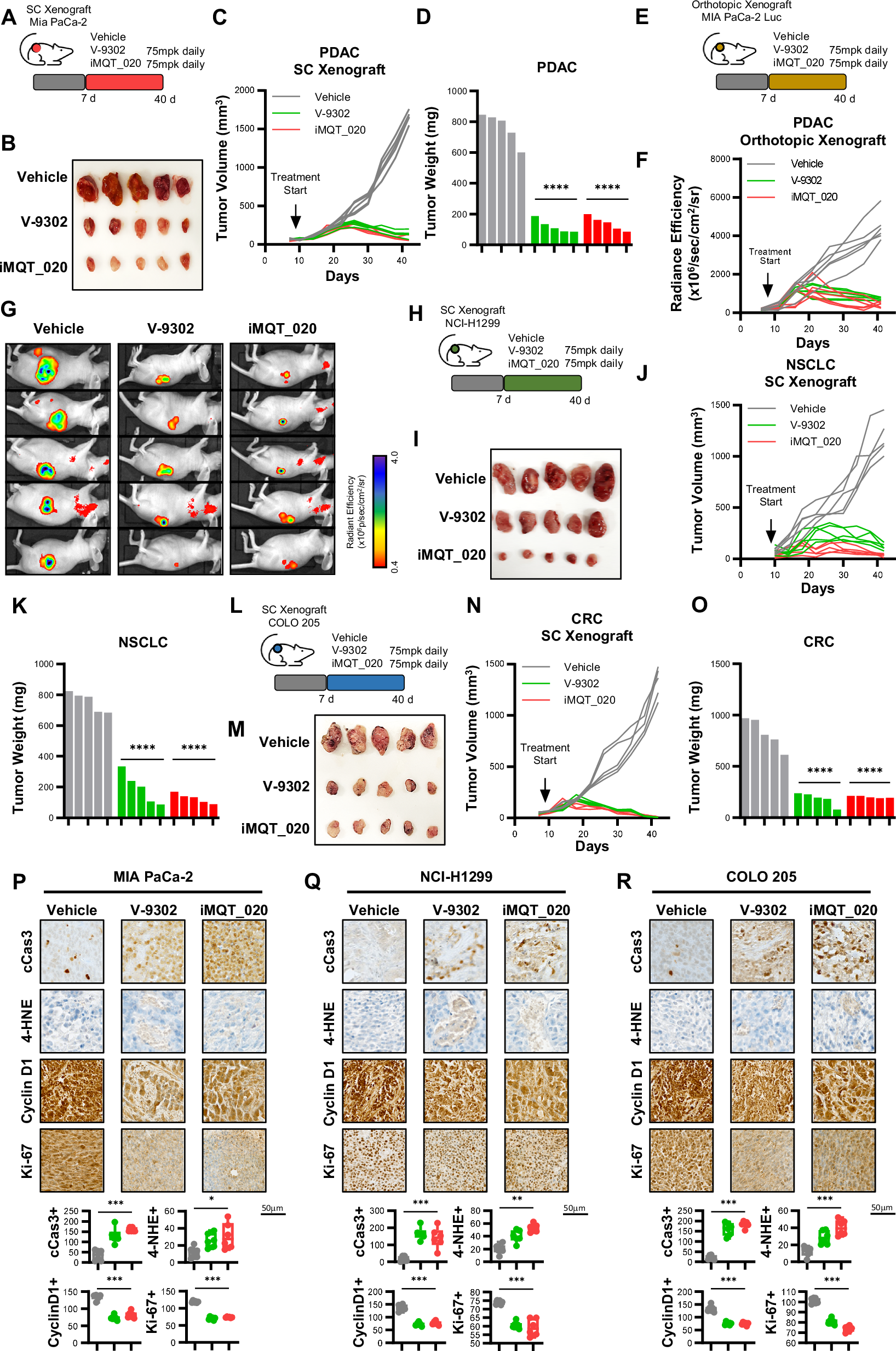 Fig. 5: Inhibition of mitochondrial SLC1A5_var inhibits cancer growth in vivo.
