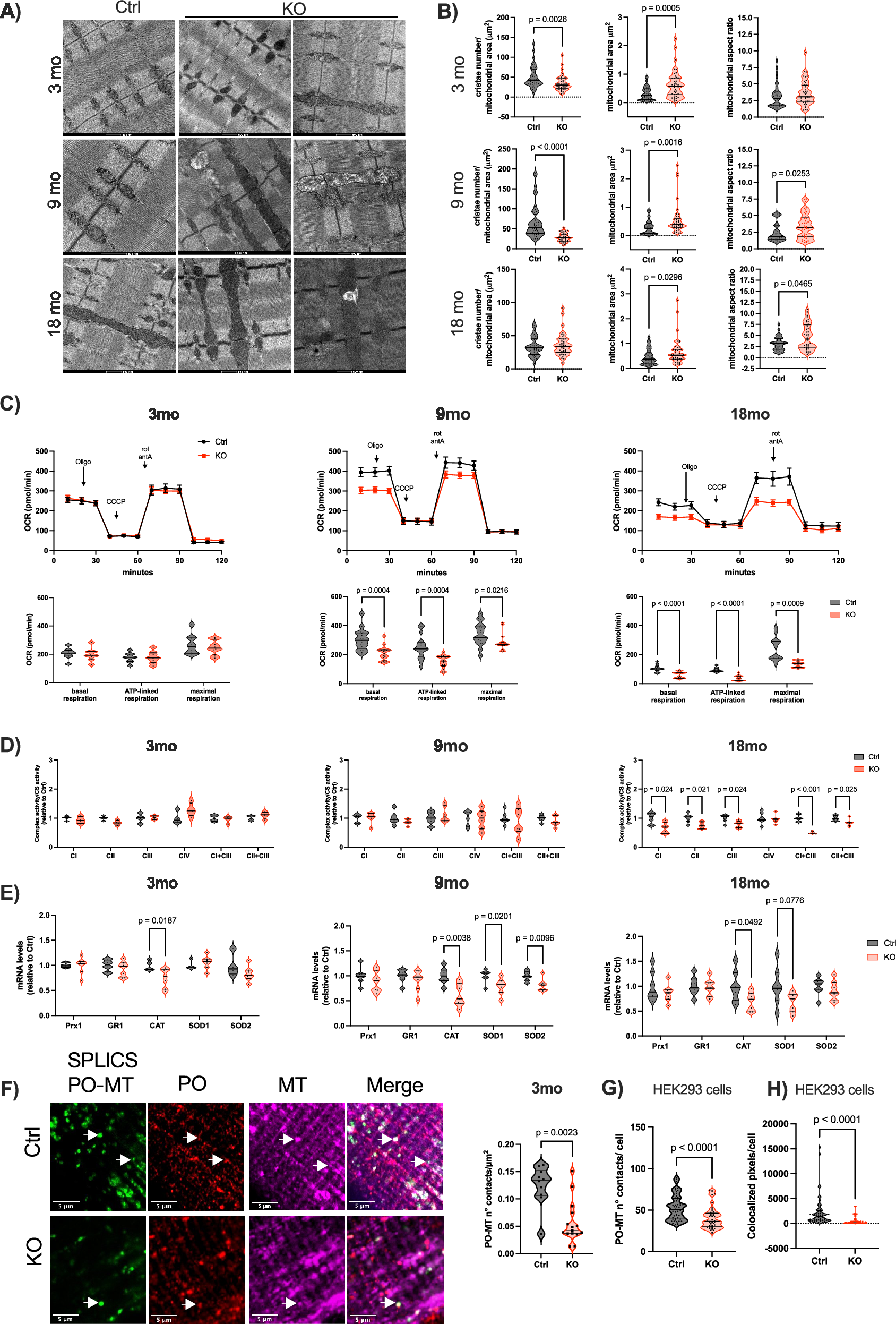 Fig. 4: Progressive mitochondrial ultrastructural and functional alterations in Pex5-null muscle.